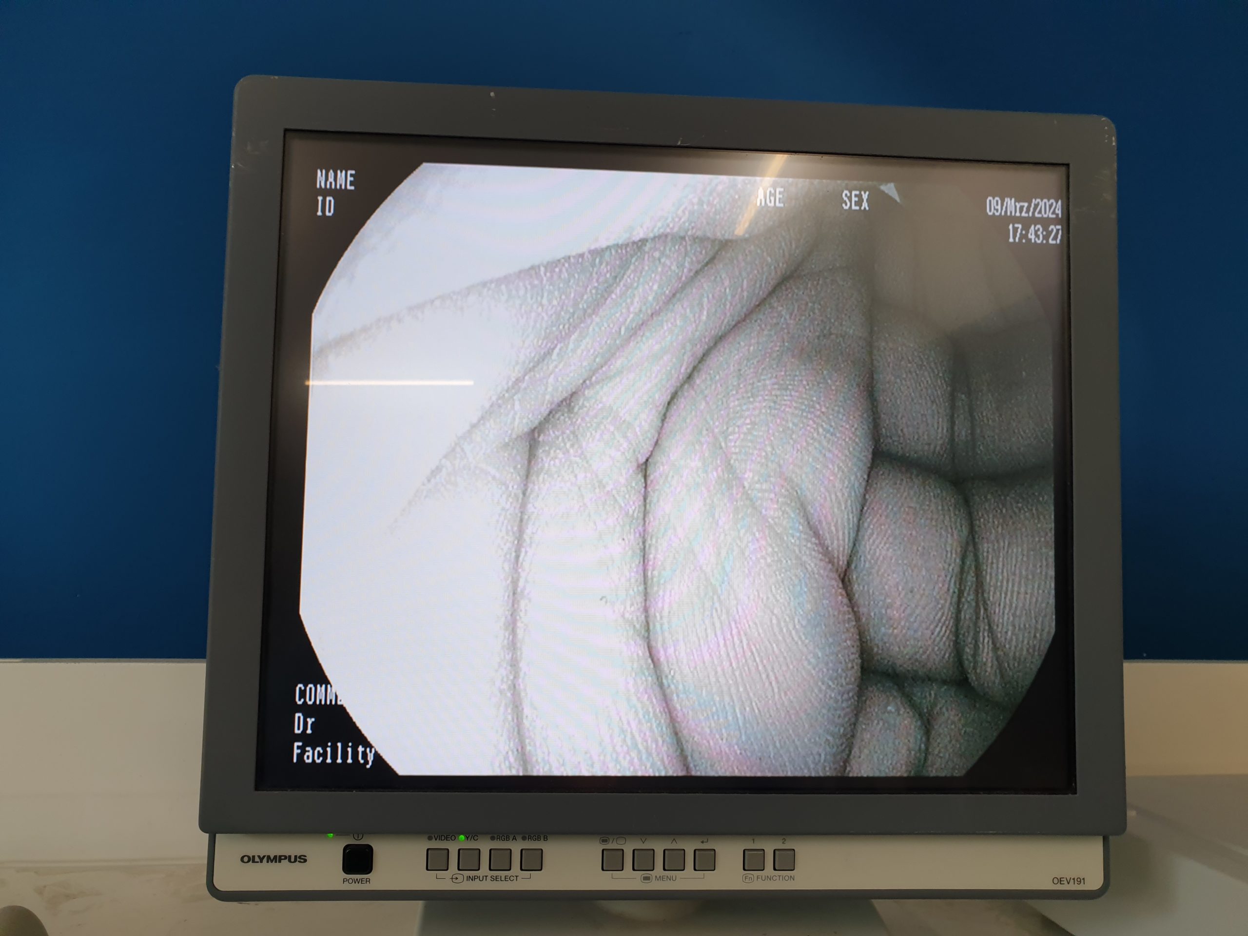 Pentax EG-2990I EG 2990 i Videogastroskop Gastroskop geprüft thumbnail 14