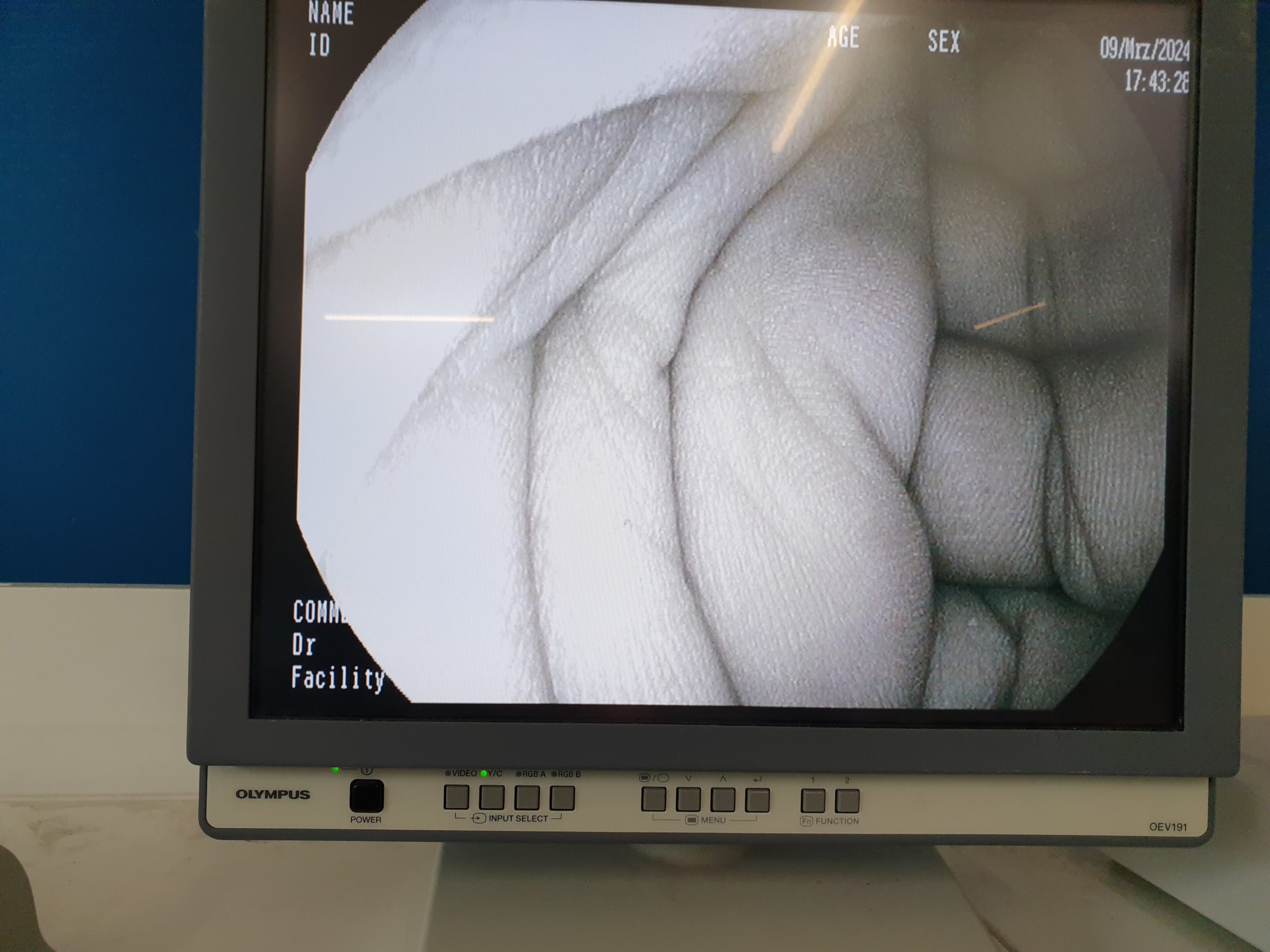 Pentax EG-2990I EG 2990 i Videogastroskop Gastroskop geprüft thumbnail 15