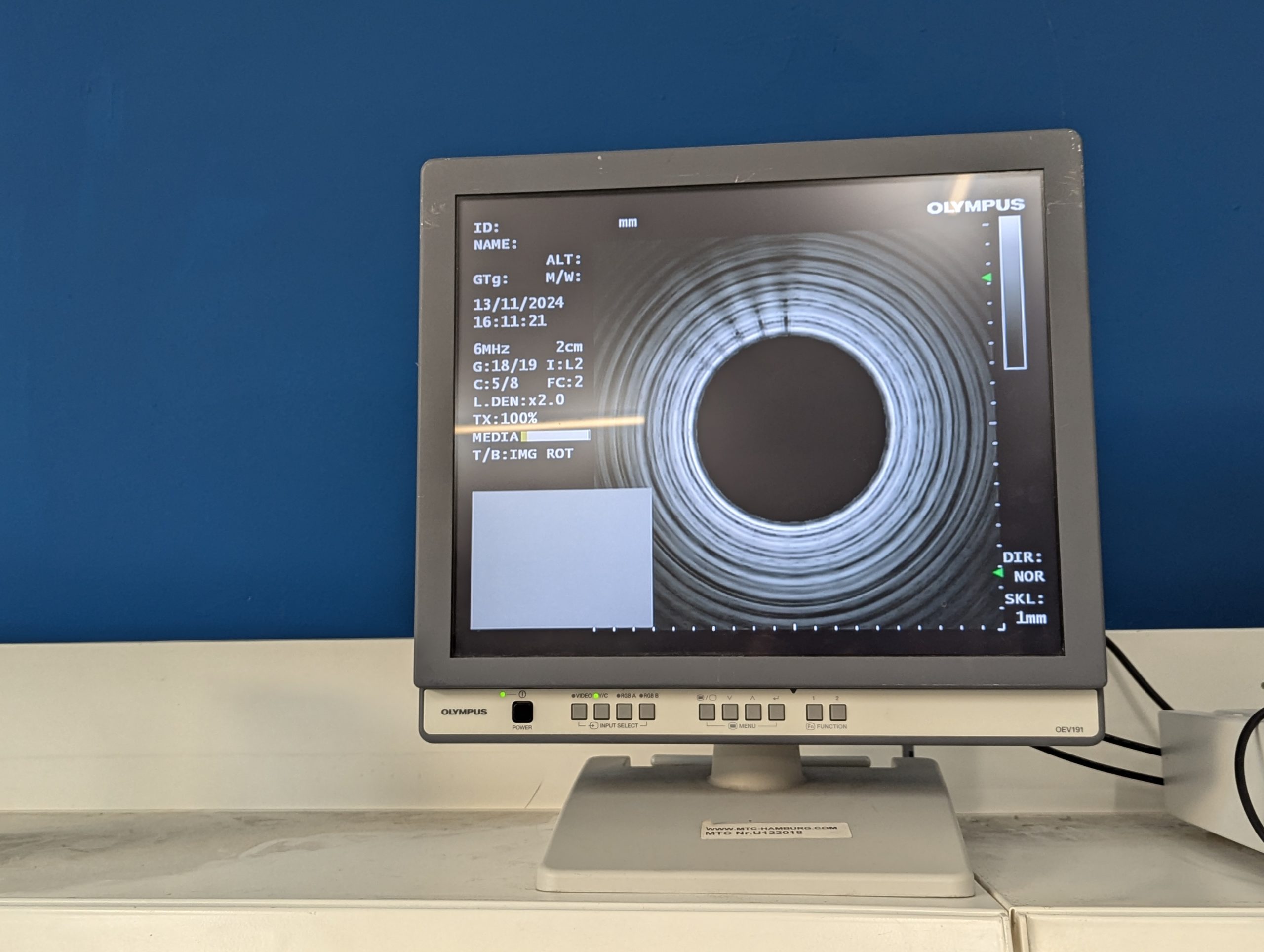 Olympus GF-UE160-AL5 Gastroskop Ultraschall Gastroskope – GEPRÜFT thumbnail 17