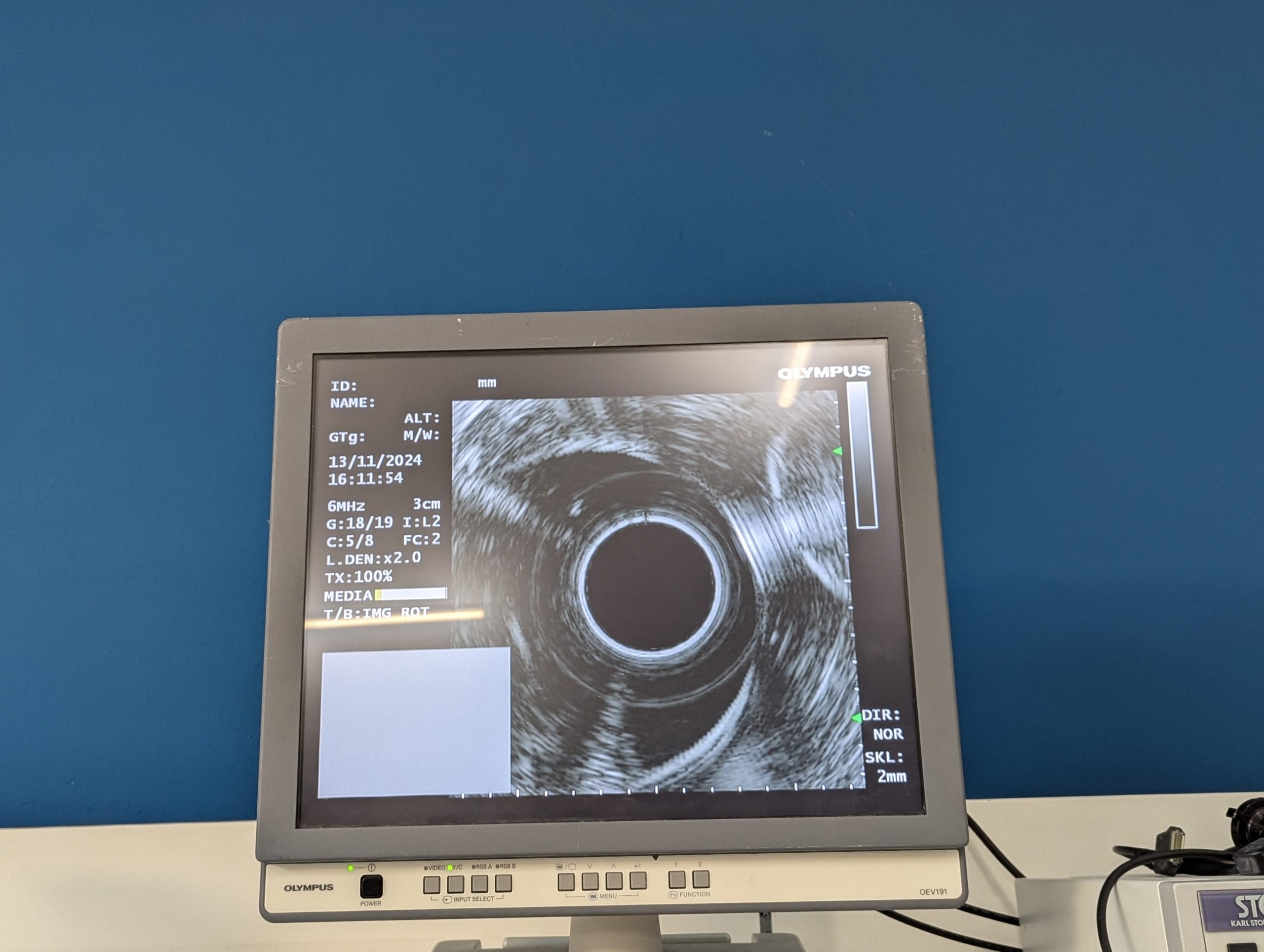 Olympus GF-UE160-AL5 Gastroskop Ultraschall Gastroskope – GEPRÜFT thumbnail 21