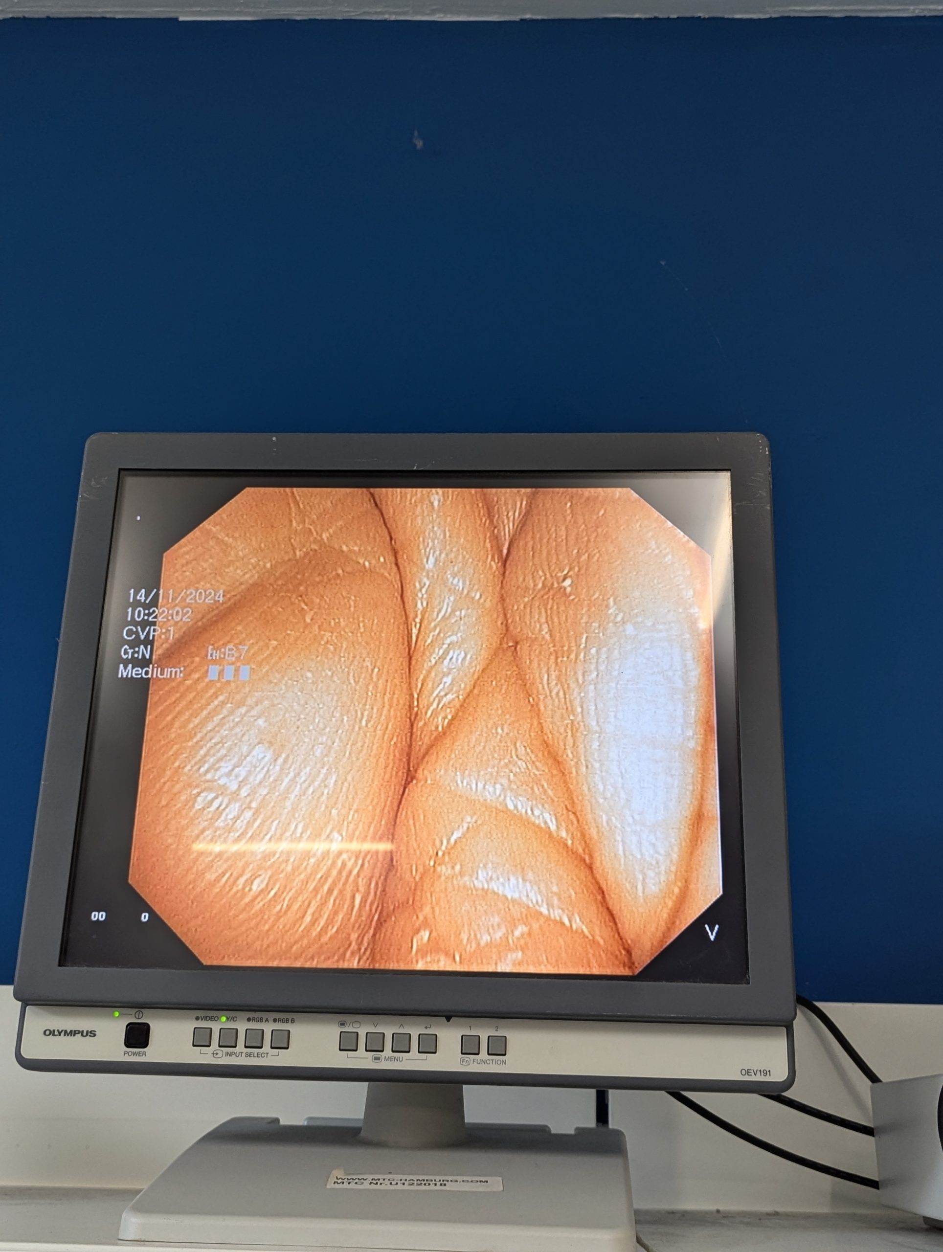 Olympus TJF Q 180 V TJF-Q180V Video Duodenoscope – Videoduodenoscope, thumbnail 20