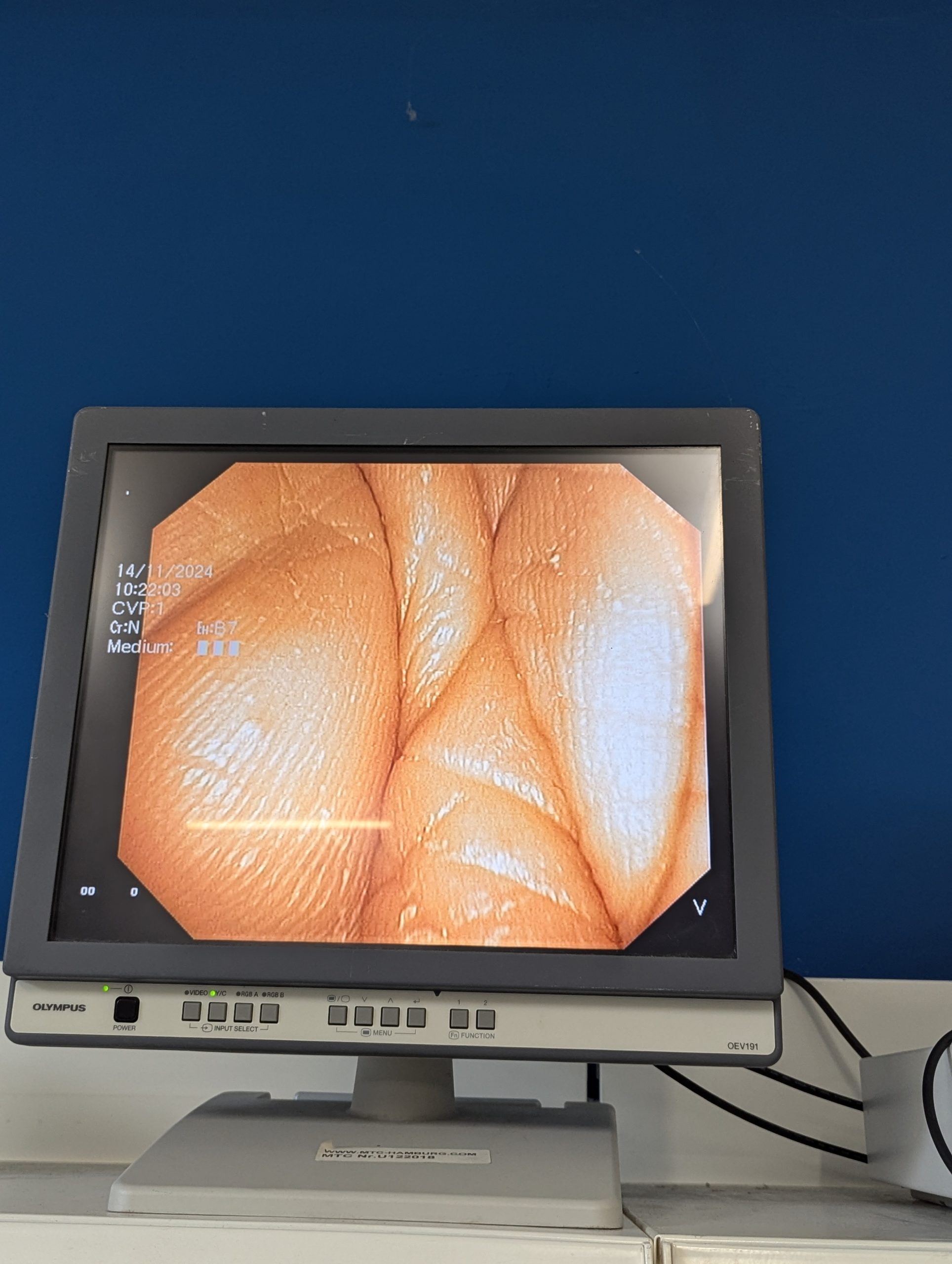 Olympus TJF Q 180 V TJF-Q180V Video Duodenoscope – Videoduodenoscope, thumbnail 21