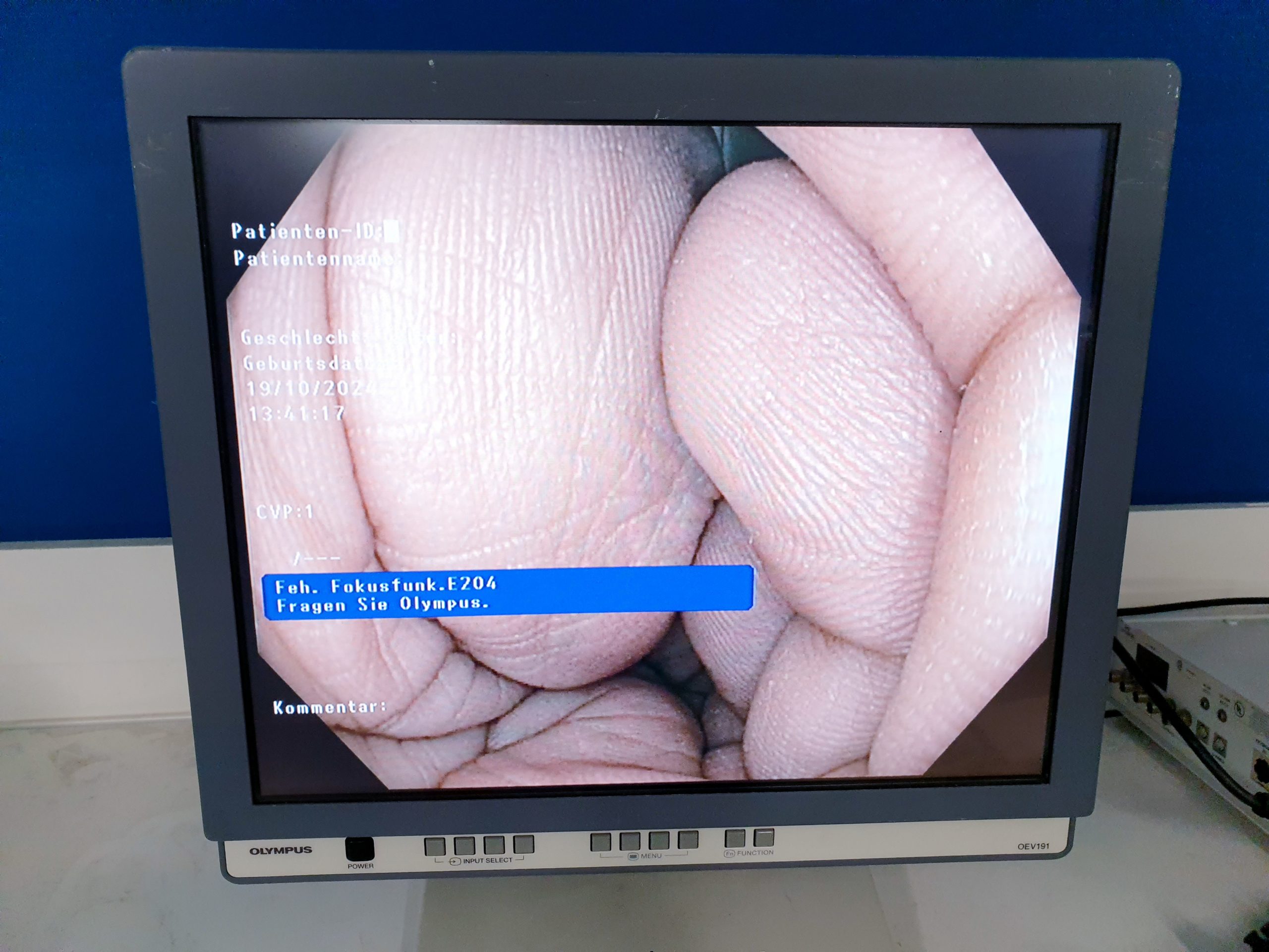 Olympus CF-HQ190L Videokoloskop HDTV thumbnail 5