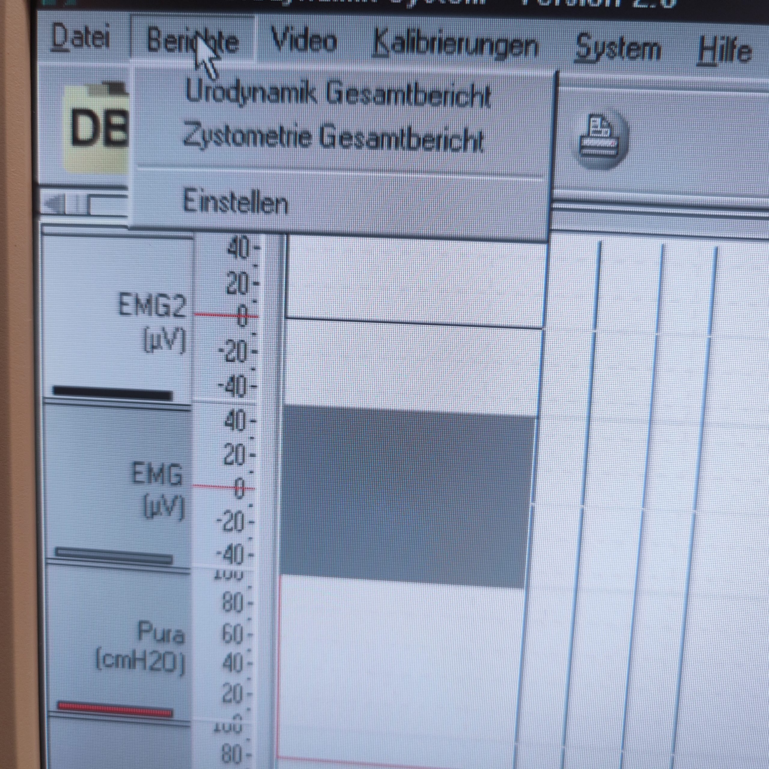 Sedia SE-6 Urodynamik Version 2.0 Zystometrie – English – Französisch – Deutsch – Italiano thumbnail 6