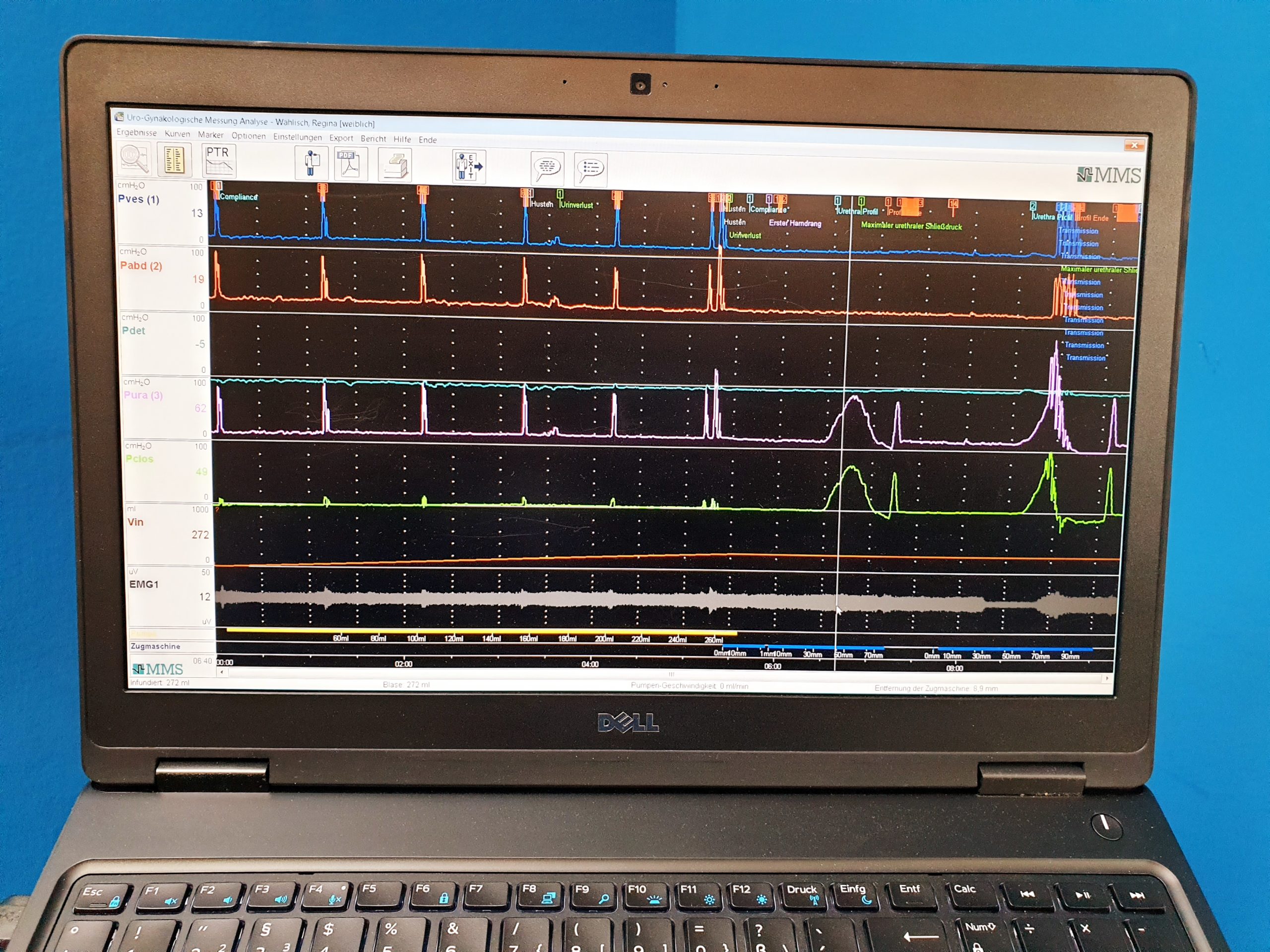 Solar Blue Module + MMS Investigation und Diagnostik Software Urodynamik System thumbnail 6