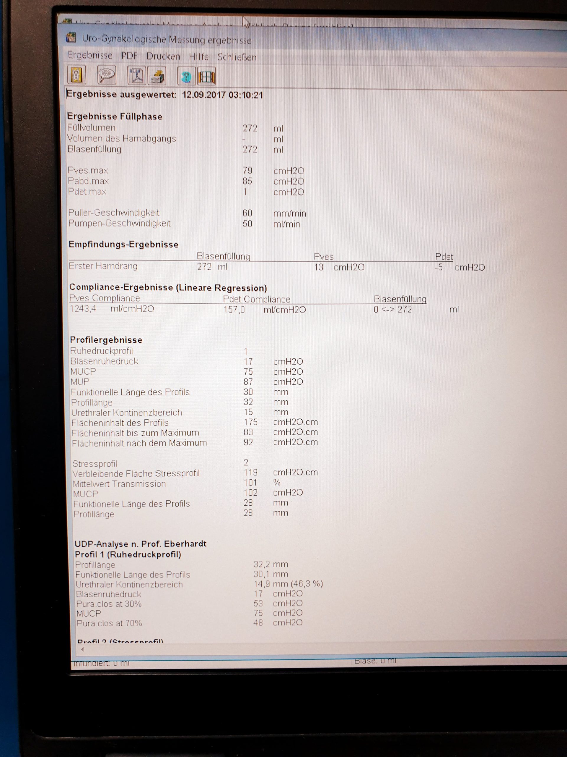 Solar Blue Module + MMS Investigation und Diagnostik Software Urodynamik System thumbnail 7