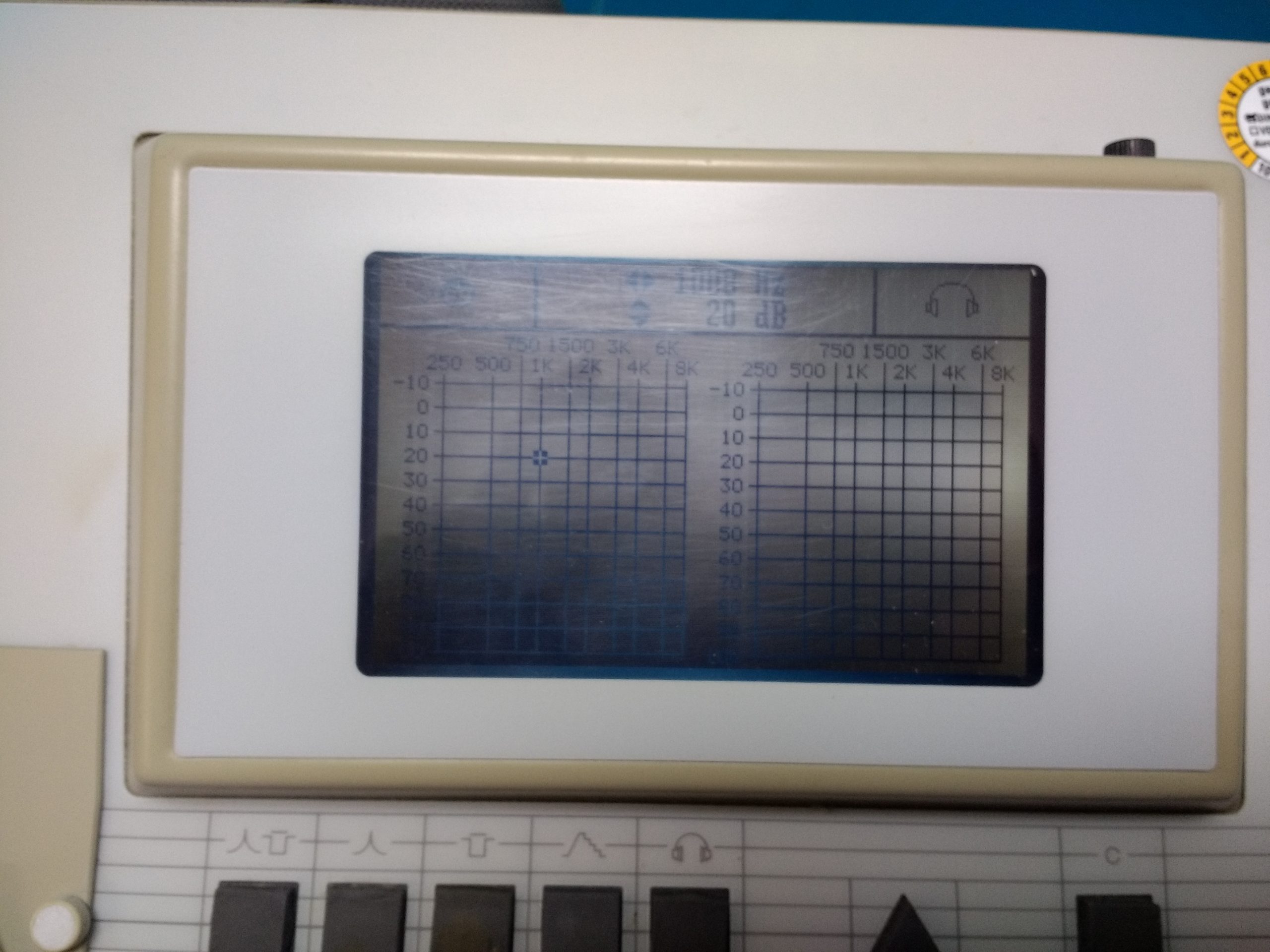 Hortmann Tymp 87 Tympanometrer — image 1 of 2