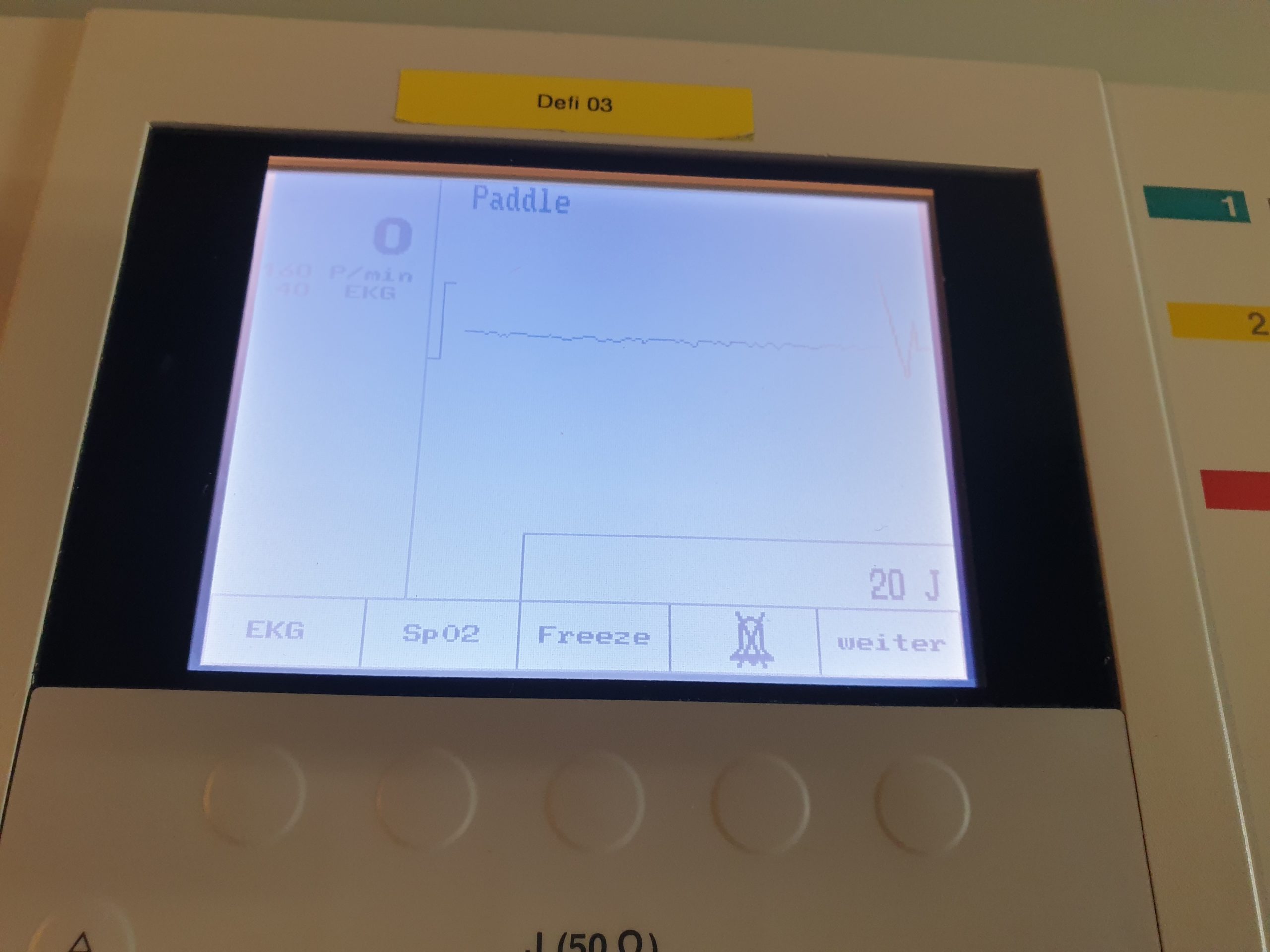 GE Hellige Cardioserv Cardio Serv Defibrillator mit EKG Kabel – thumbnail 2