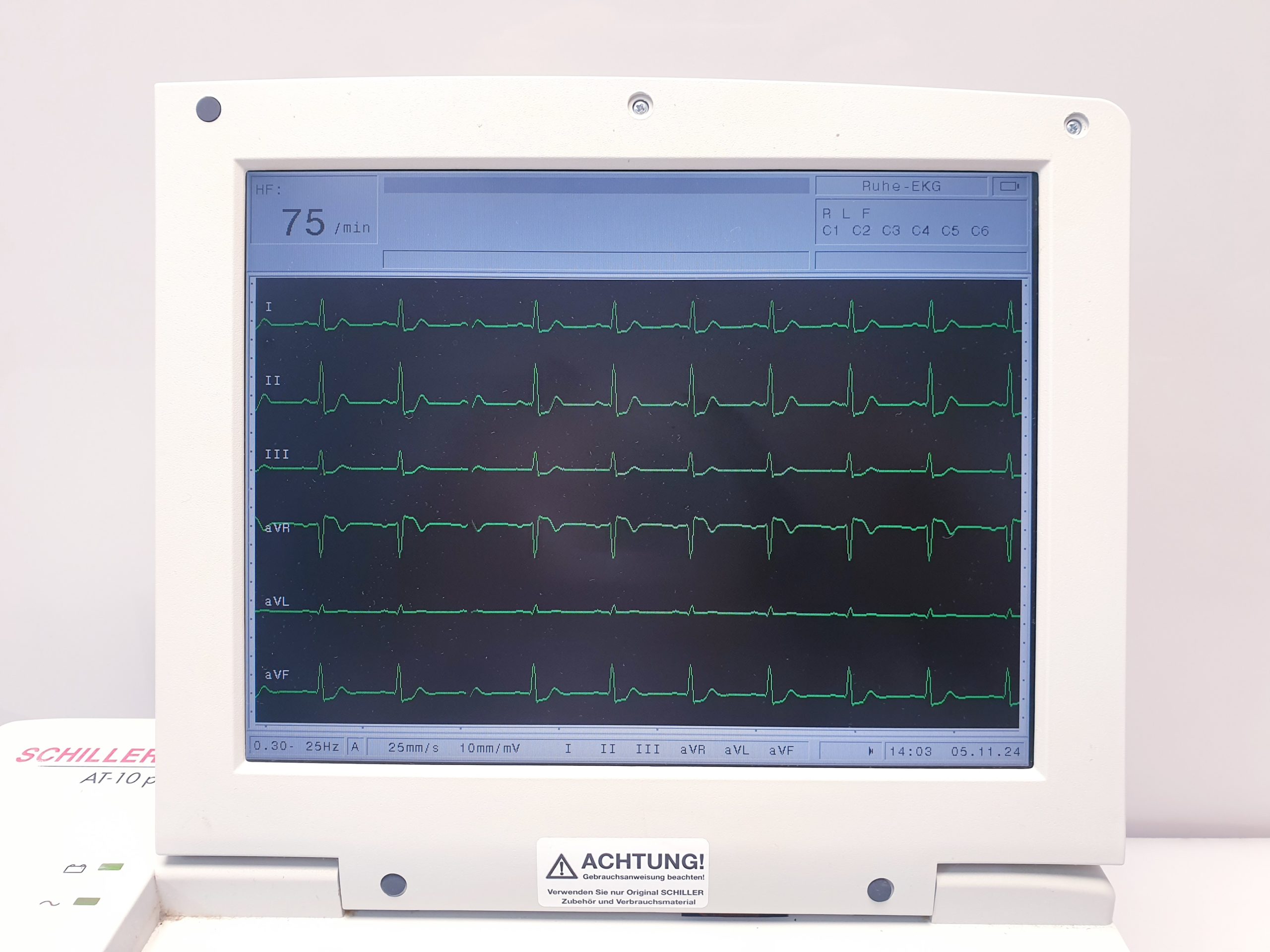 Schiller AT-10 PLUS EKG 12 Kanal Gerät mit LCD Display thumbnail 4