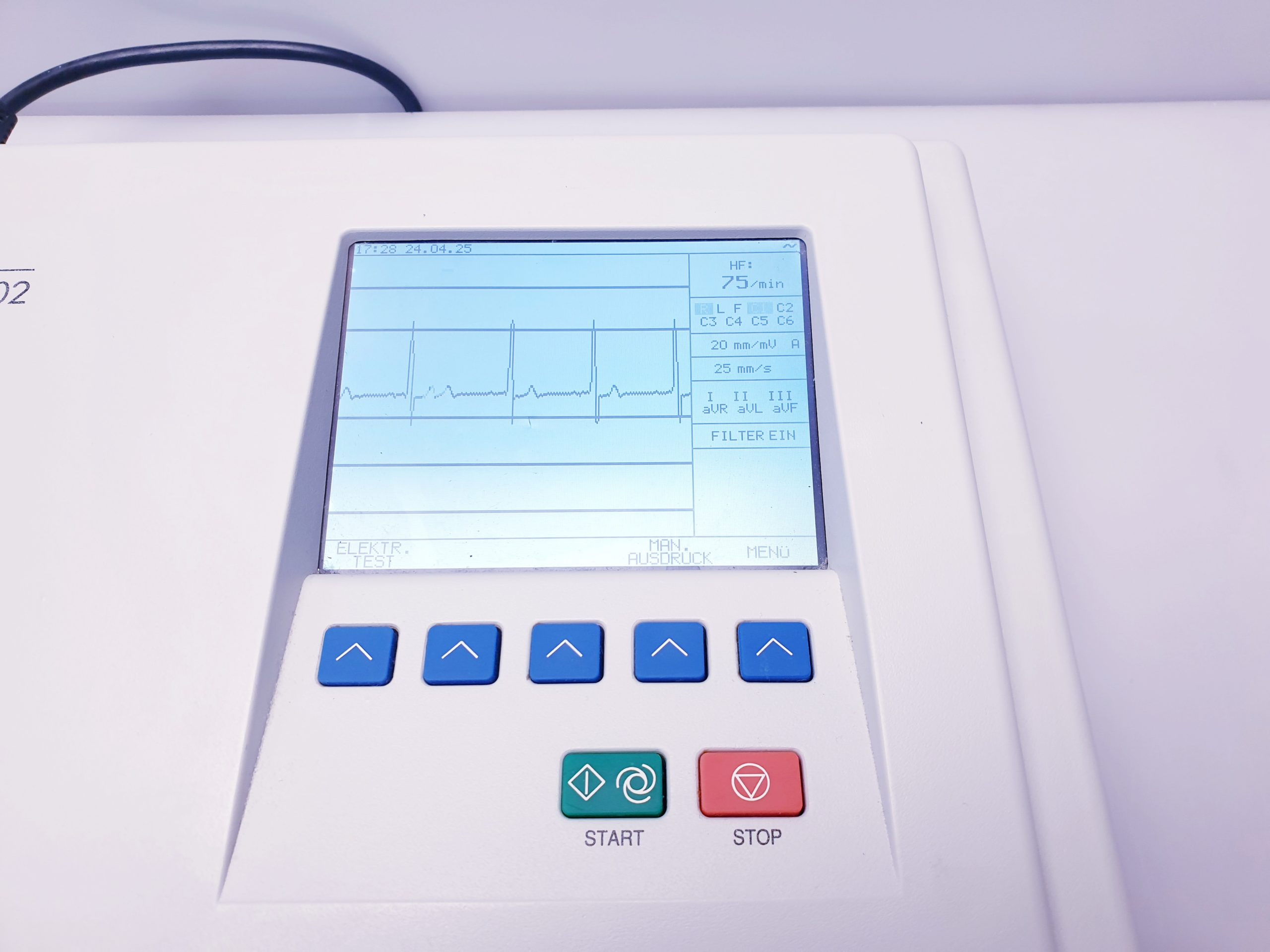 Schiller AT-102 plus – EKG – mit Patientenkabel thumbnail 6