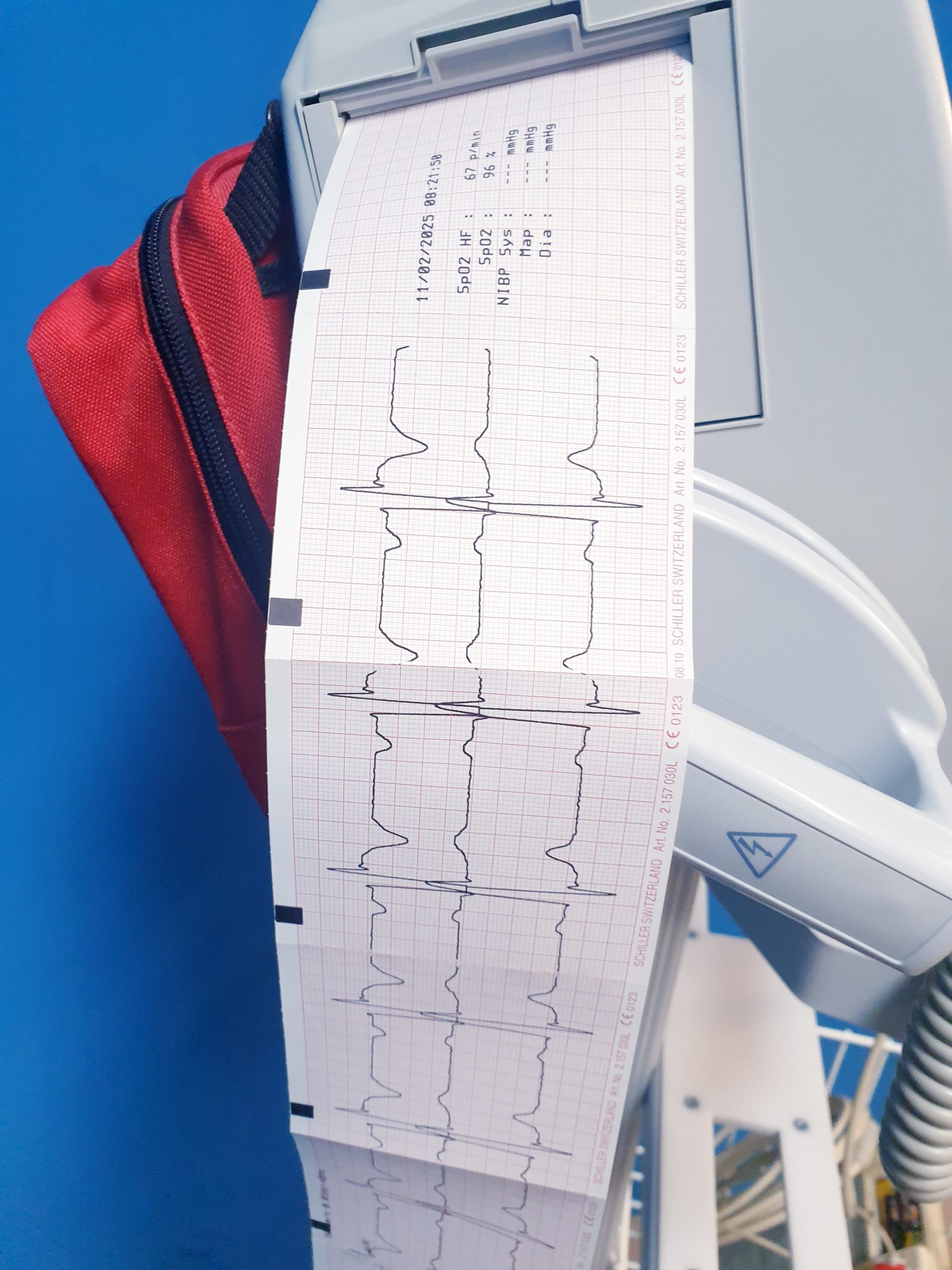 Schiller Defigrad 5000 – Defibrillator – auf fahrbarem Gestell thumbnail 5