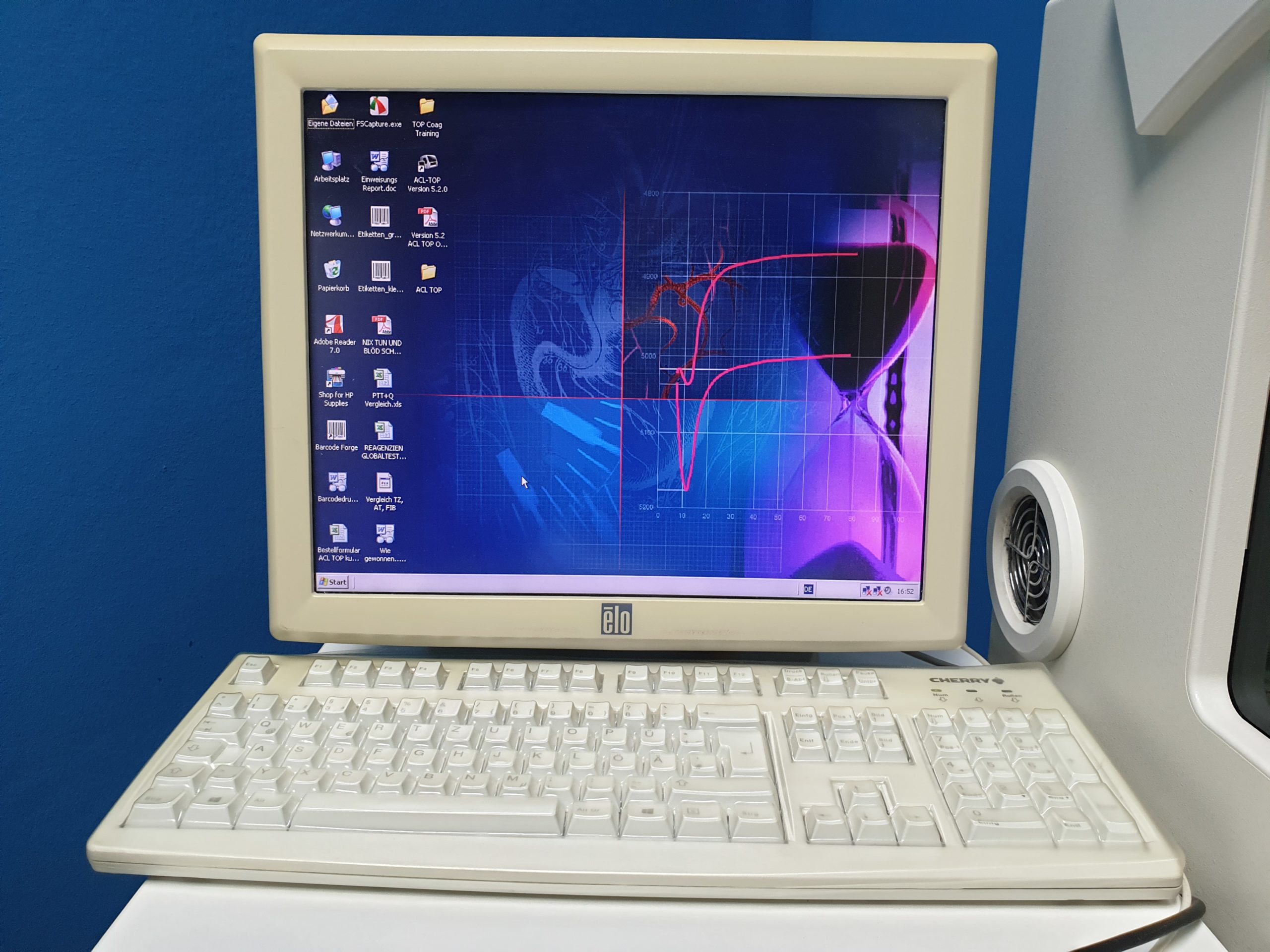 ACL TOP 500 CTS Koagulation-Analyser mit Software thumbnail 3