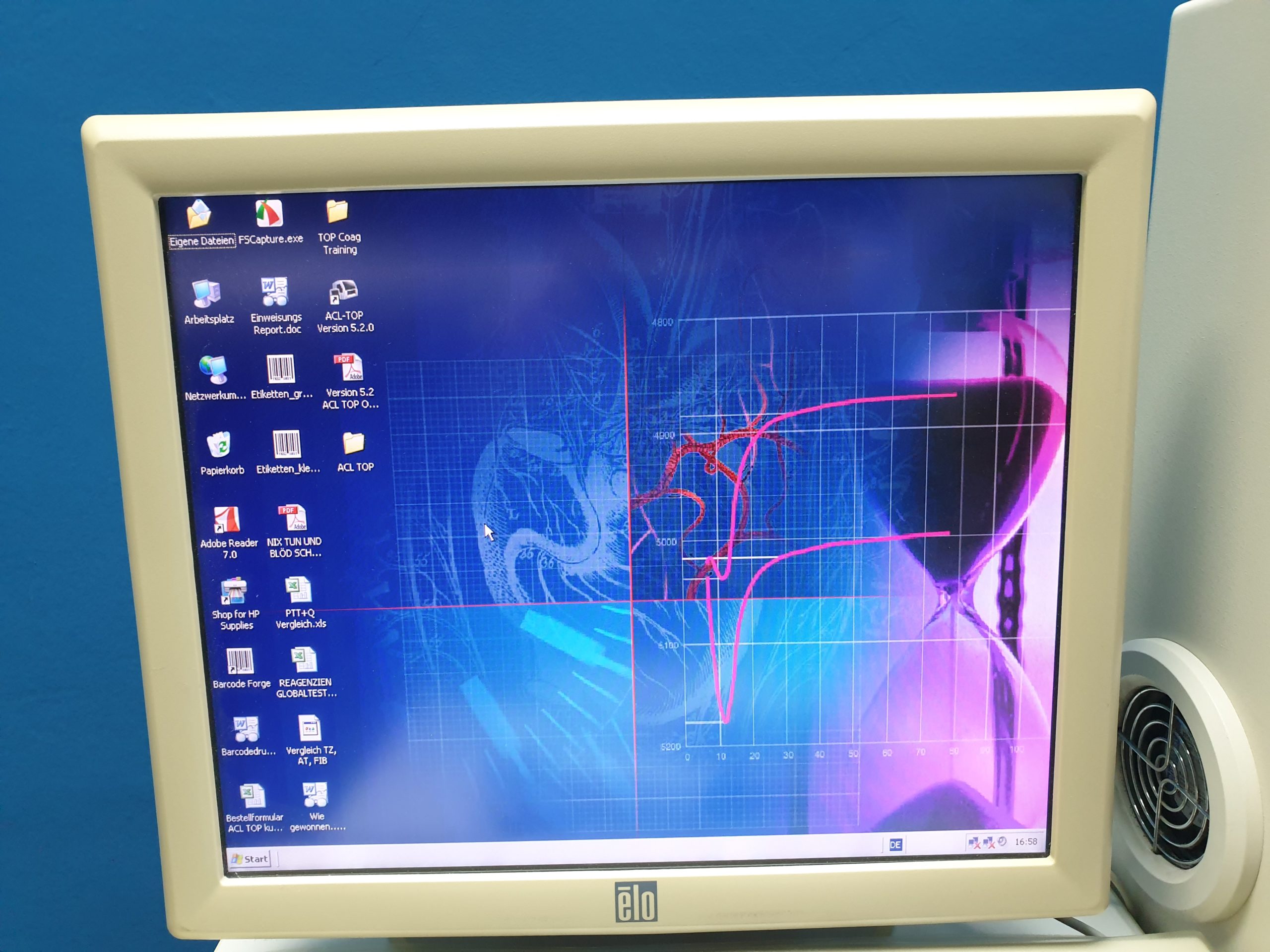 ACL TOP 500 CTS Koagulation-Analyser mit Software thumbnail 10