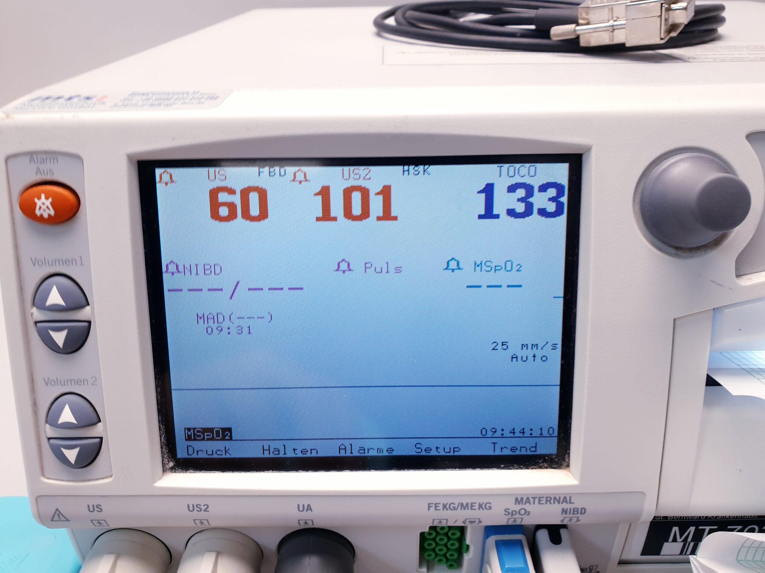 Ge Corometrics 259CX-C Fetal CTG Mutter Überwachungssystem thumbnail 5