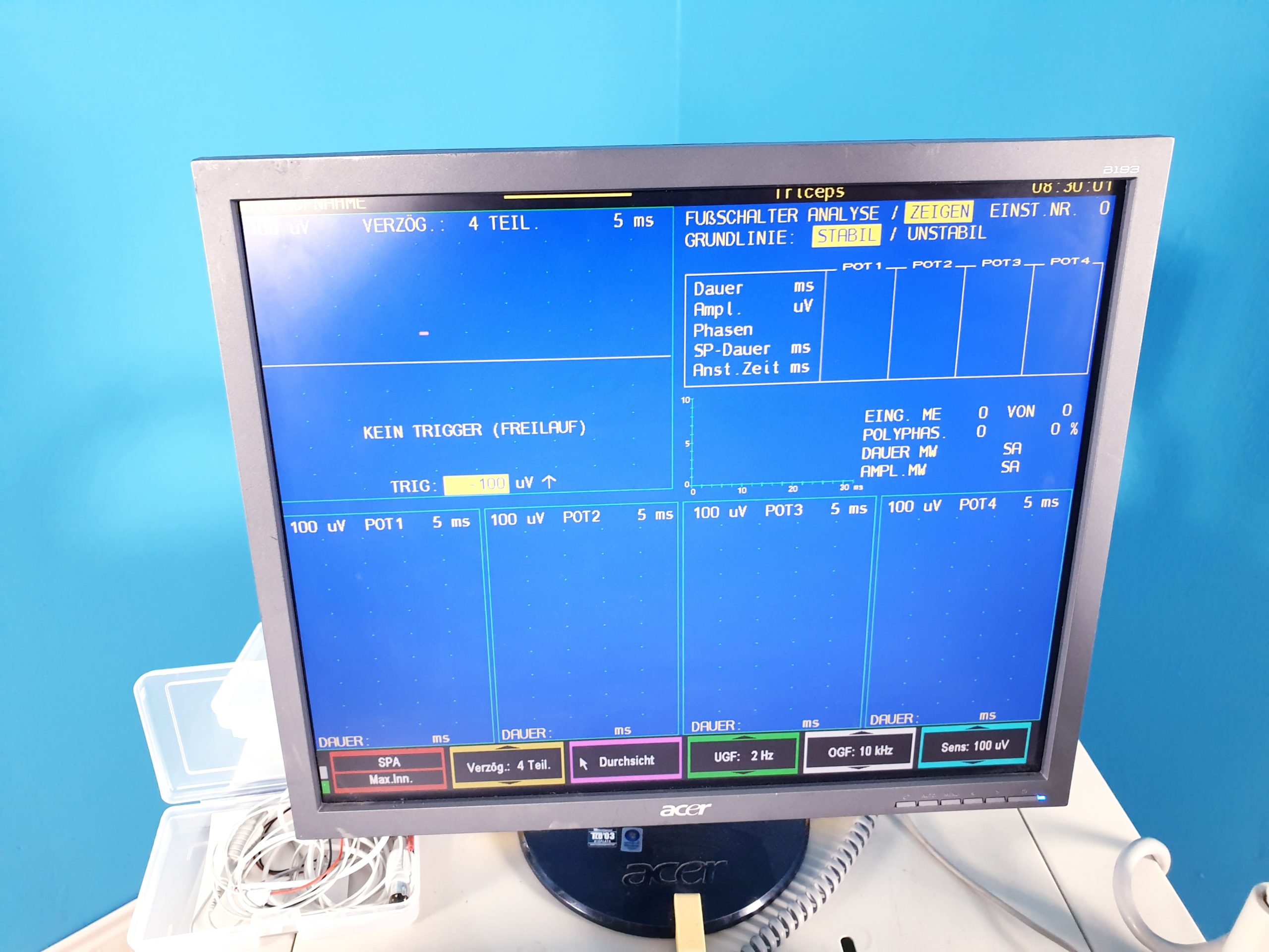 Nicolet Viking IV EMG Unit EMG SYSTEM MESSSYSTEM NEURO thumbnail 10