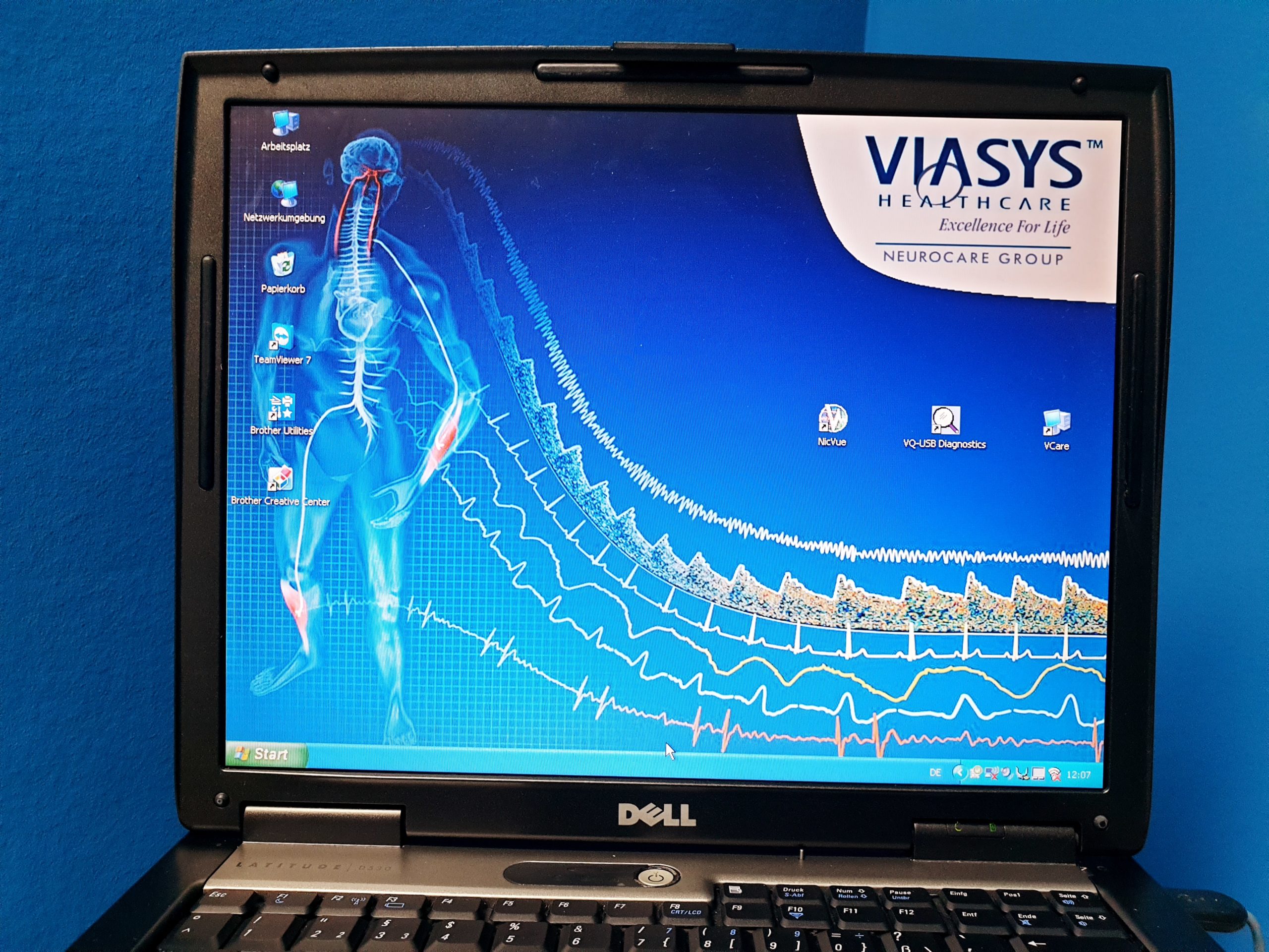 VIASYS HEALTHCARE VikingQuest EMG NicVue thumbnail 2