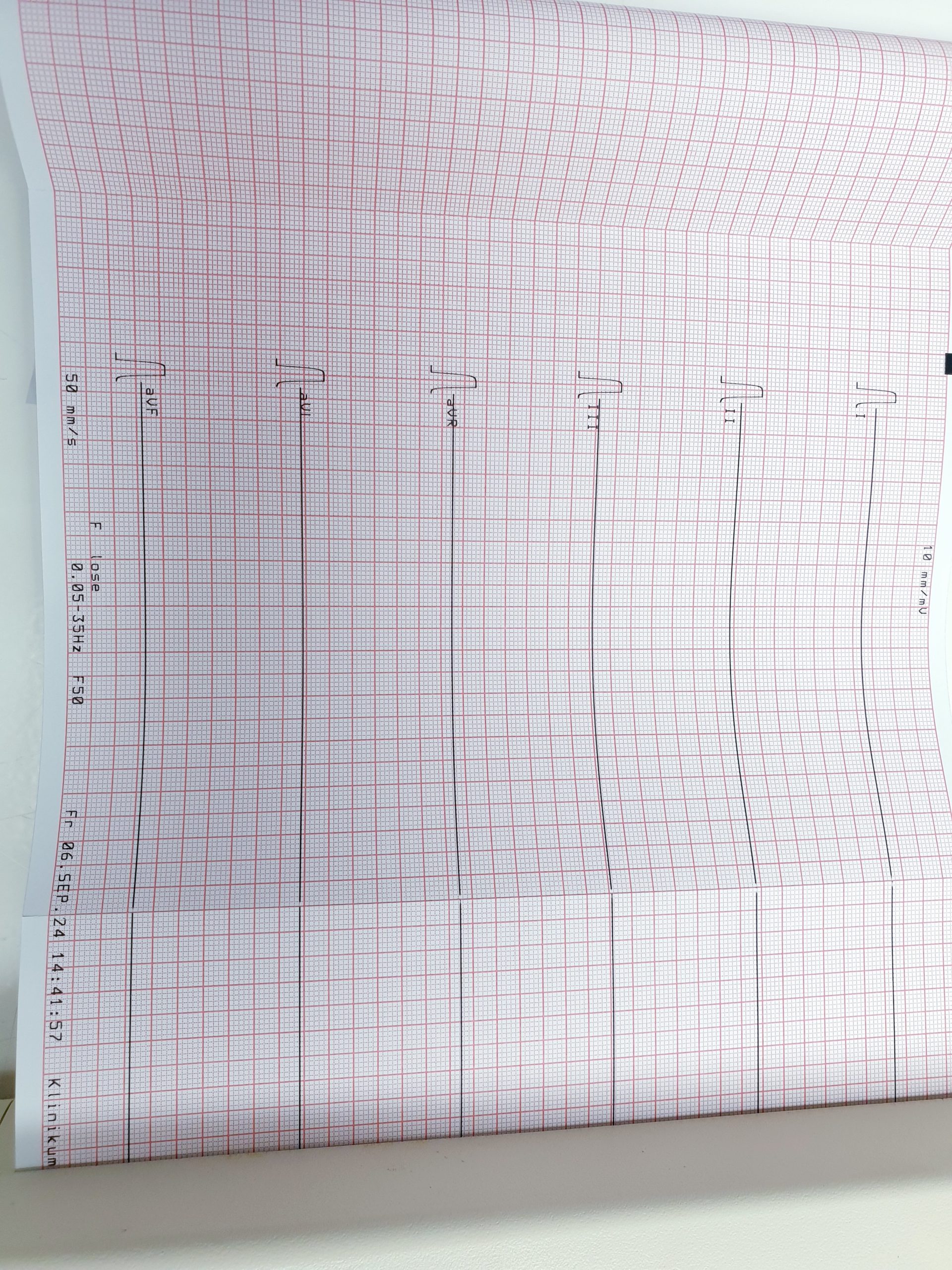Zimmer Cardiocompact P8000 Power EKG – Gerät thumbnail 8