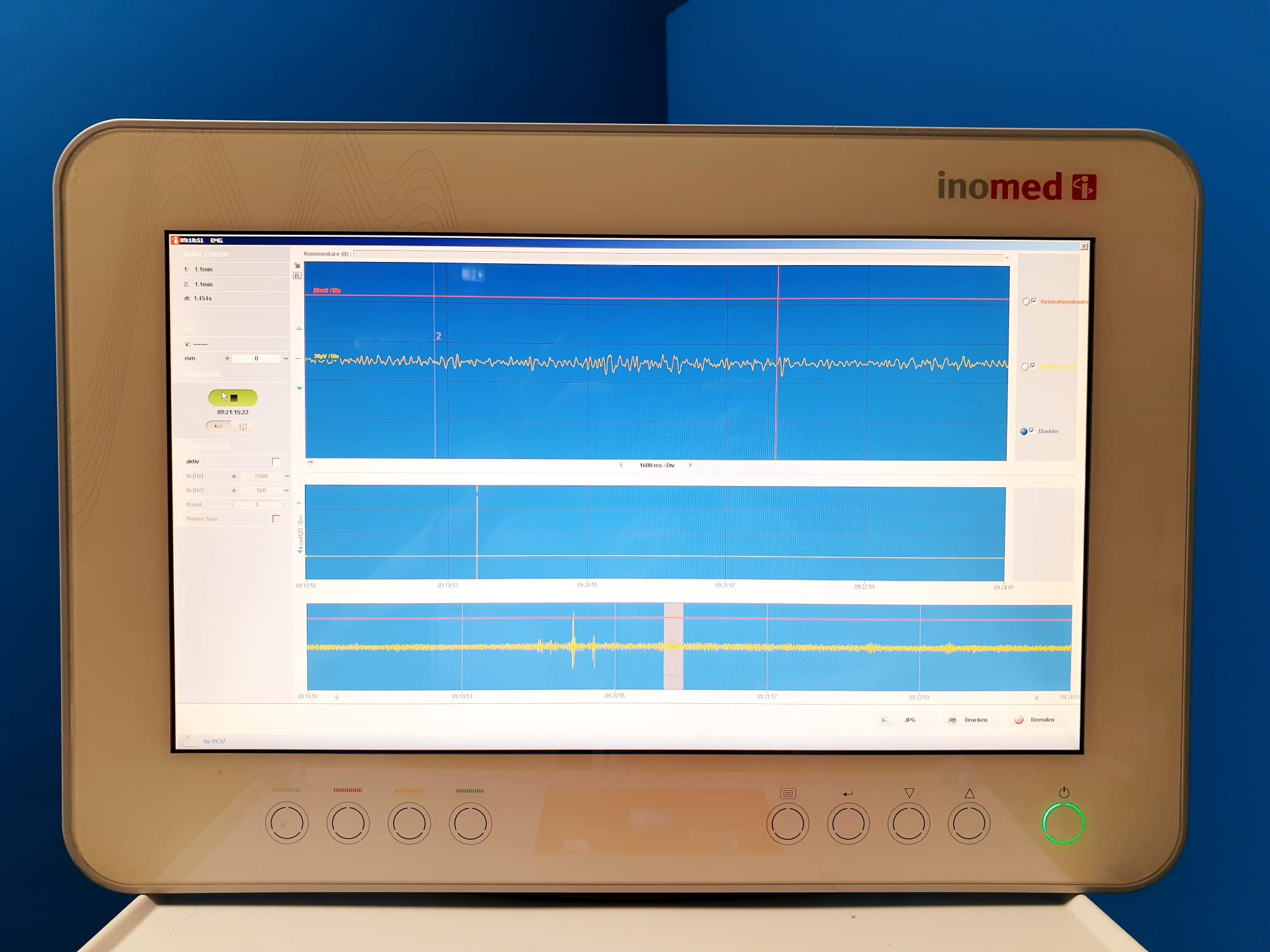 Inomed Medizintechnik Evozierte-Potentiale-Einheit Neurostimulator DNS + ISI HEADBOX 12 Chanels thumbnail 10