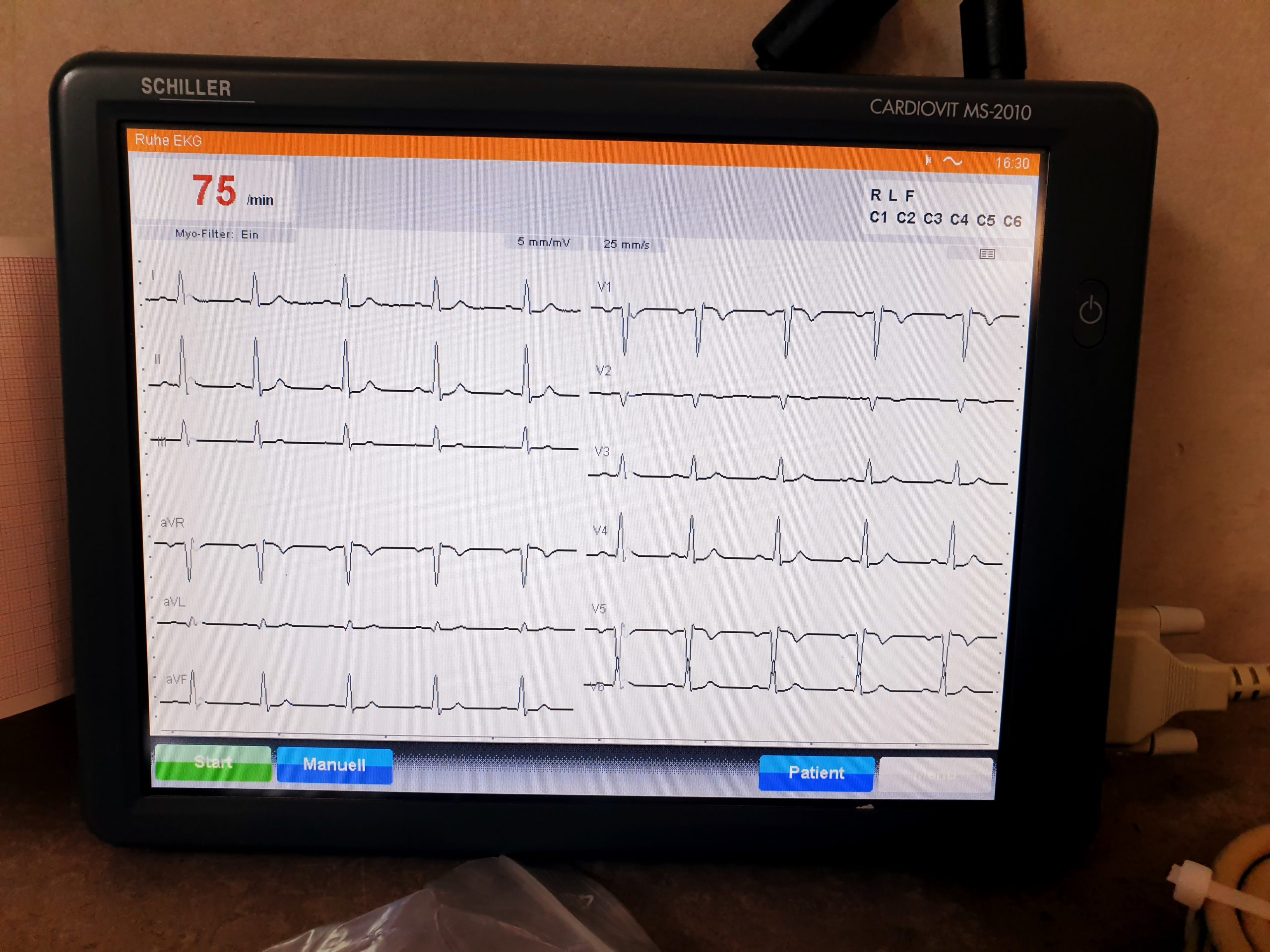SCHILLER Cardiovit MS-2010 MS 2010 12 Kanal thumbnail 3