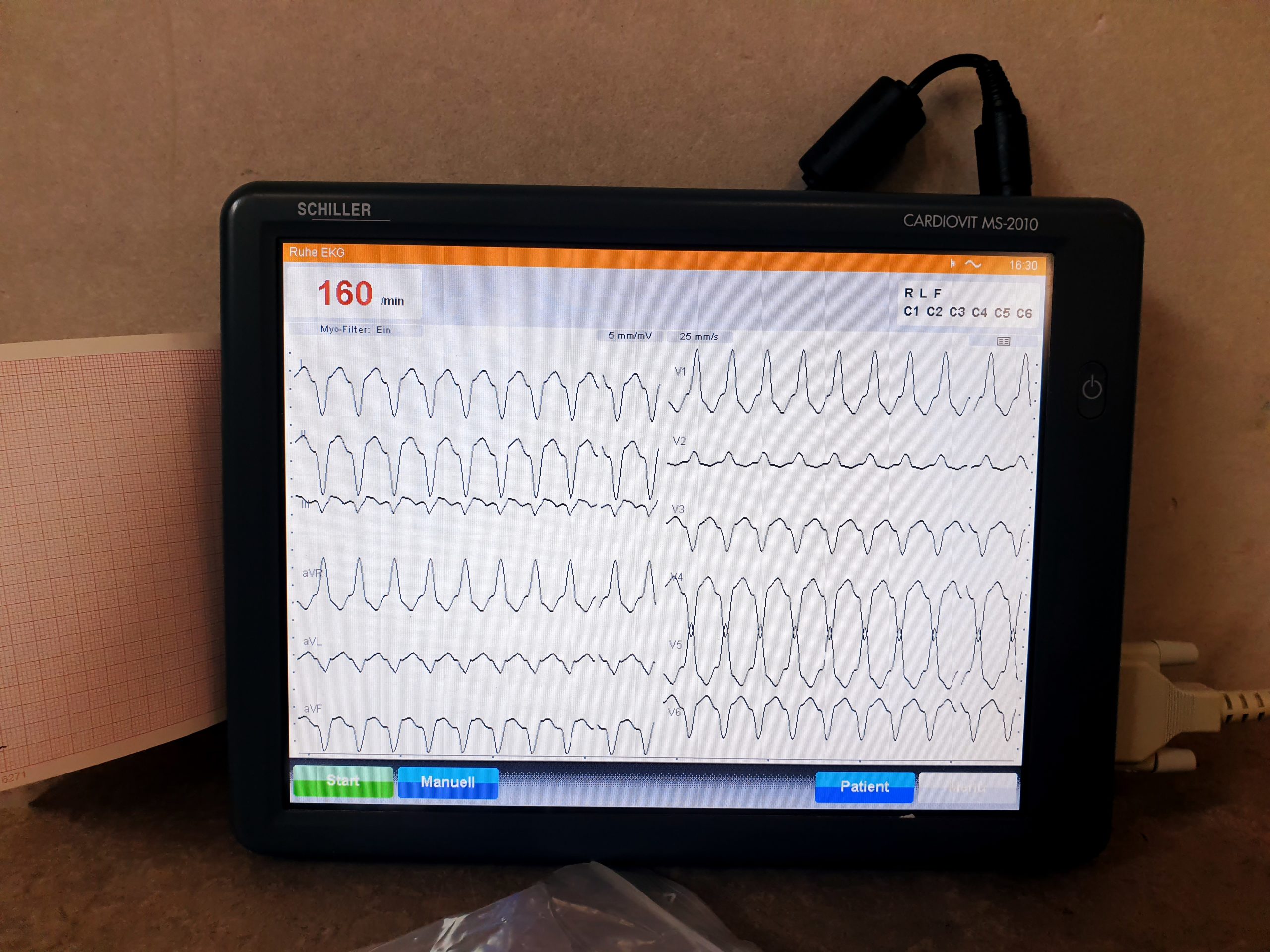 SCHILLER Cardiovit MS-2010 MS 2010 12 Kanal thumbnail 4