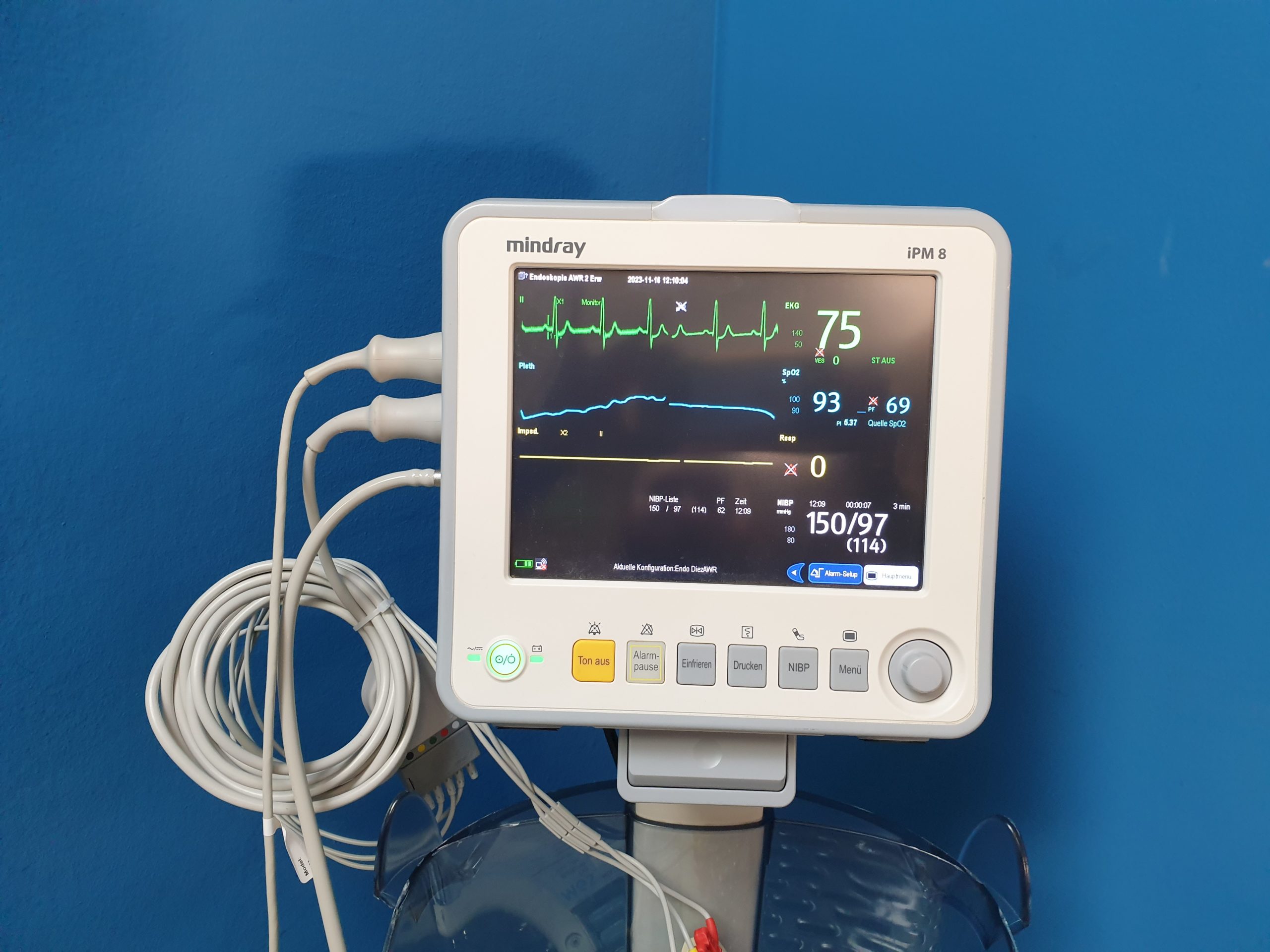 MINDRAY iPM 8 iPM8 Monitor – Übeerwachungsmonitor + EKG Ableitungskabel + SpO2 Sensor + Blutdruckmanschette thumbnail 2