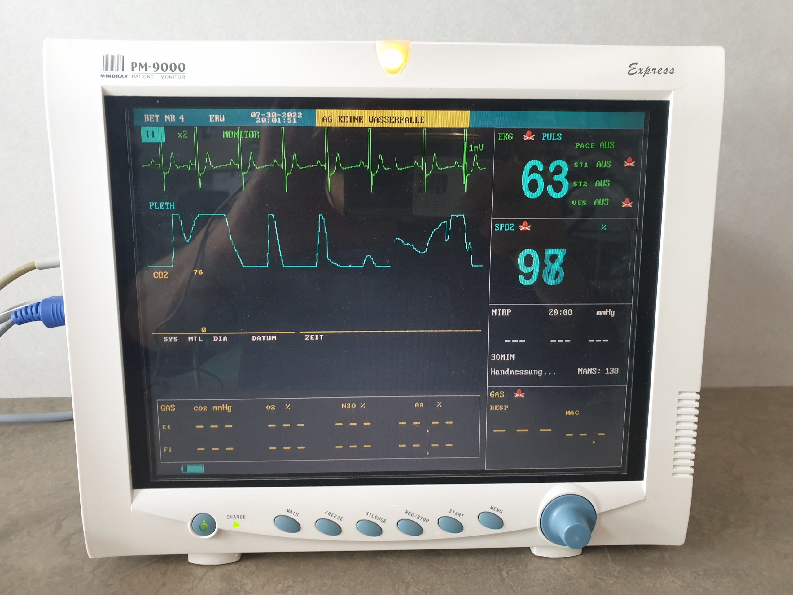 Mindray PM-9000 Express Patientenmonitor mit Zubehör thumbnail 2