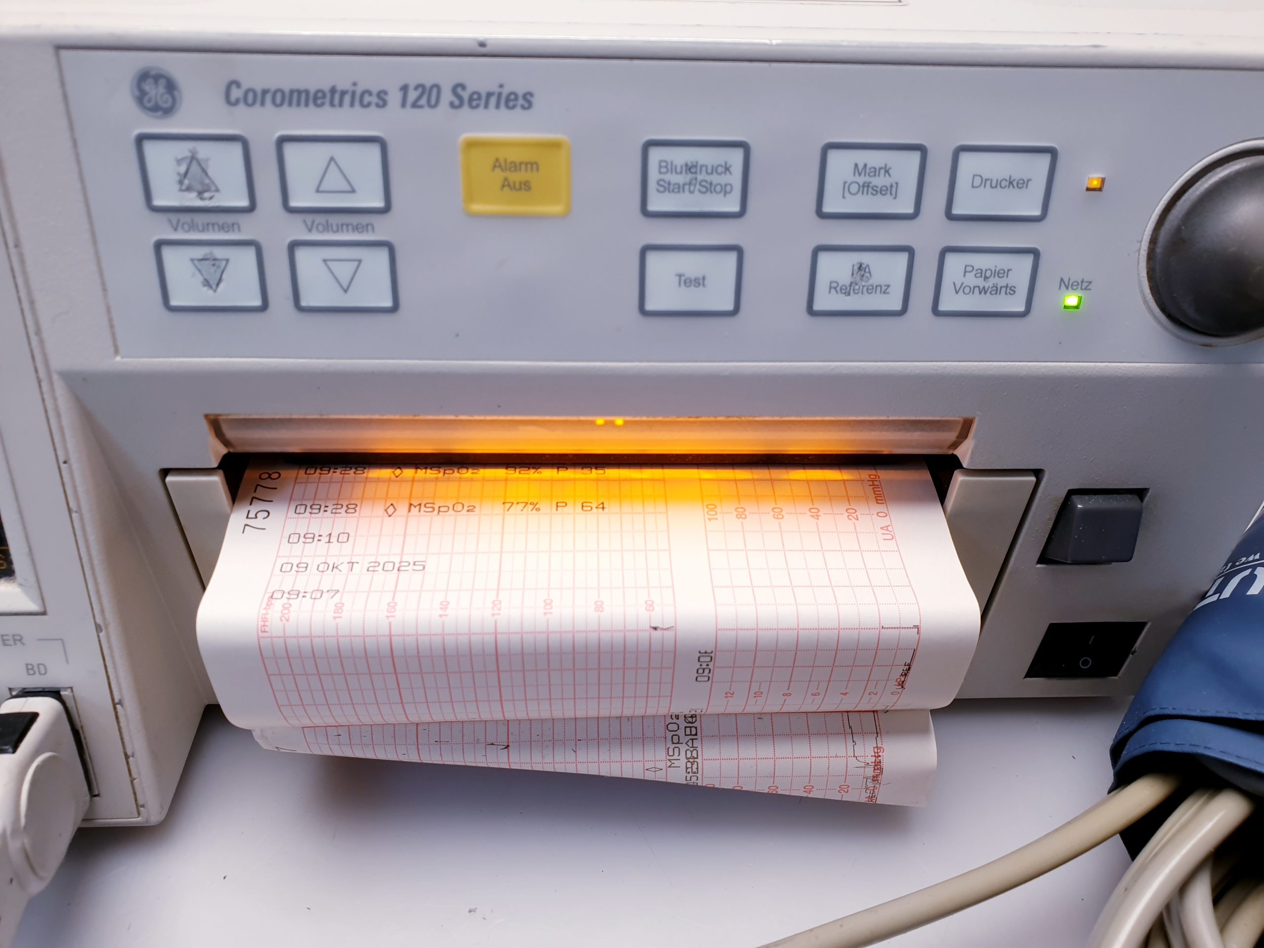 Corometrics 120 series CTG + SpO2 Sensor + Aufnehmen thumbnail 14