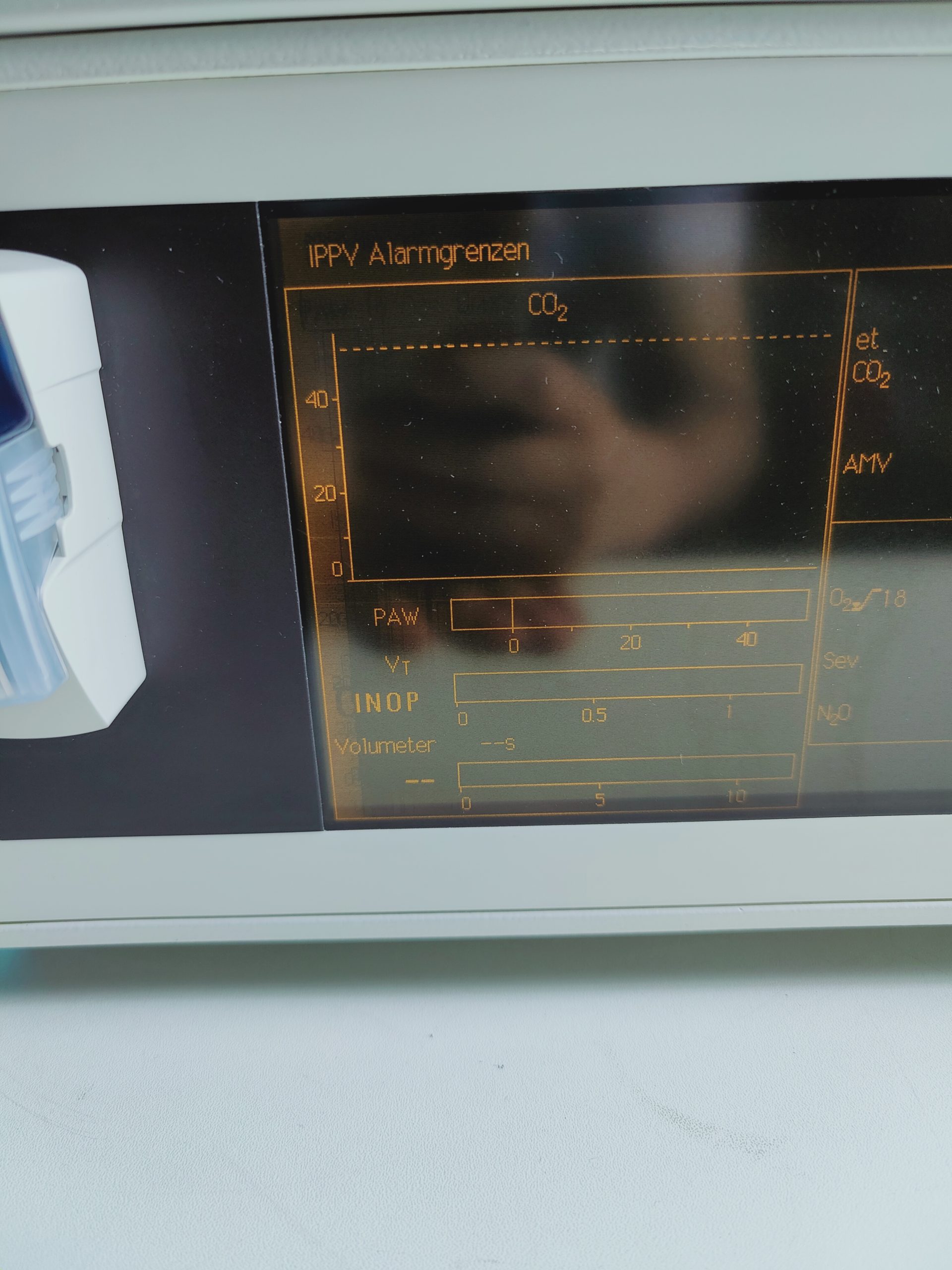 Dräger PM 8050 // PM8050 Narkosegasmonitor, Atemgasmonitor thumbnail 3