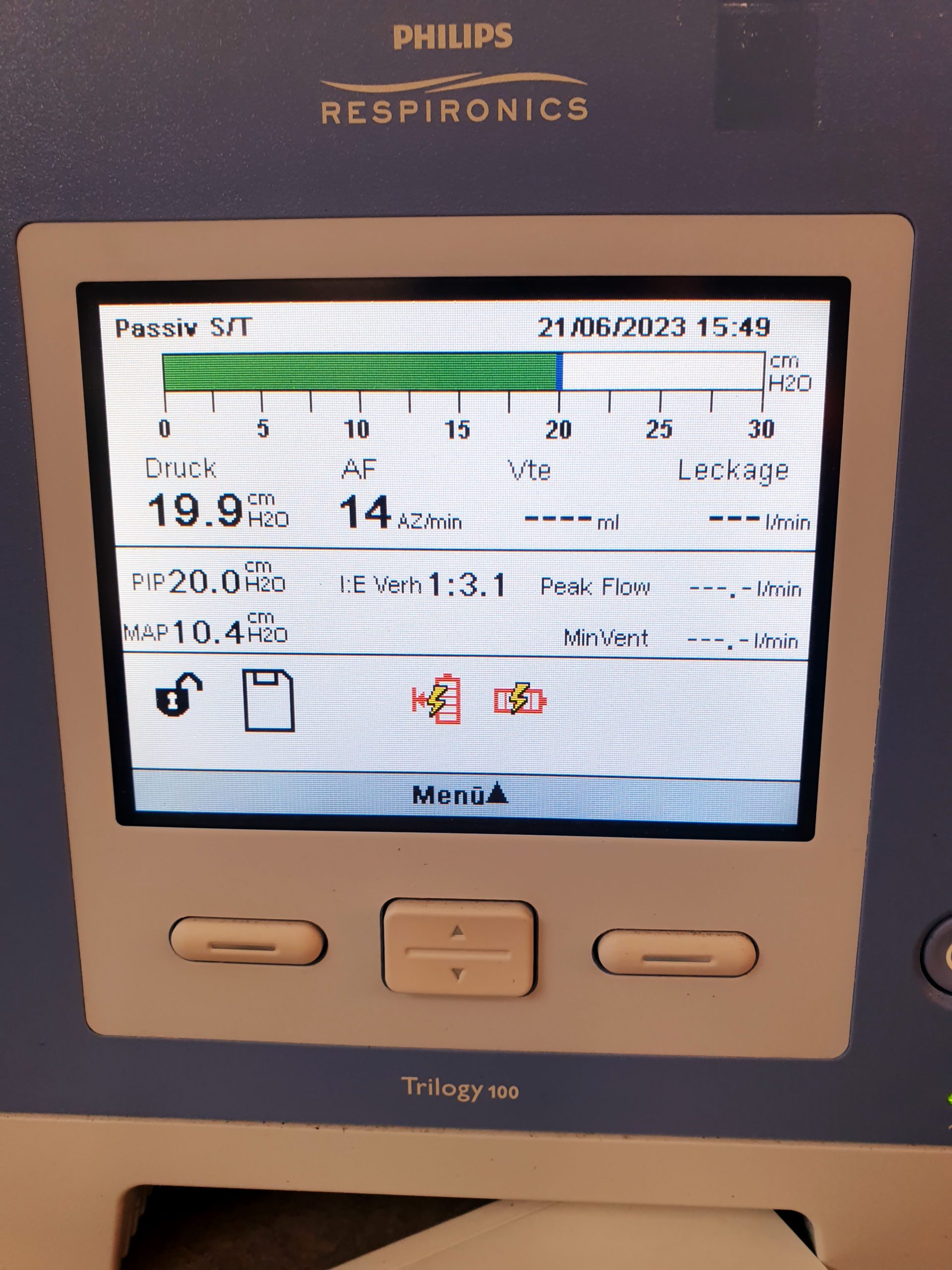 Philips Respironics Trilogy 100 Ventilator — image 1 of 3