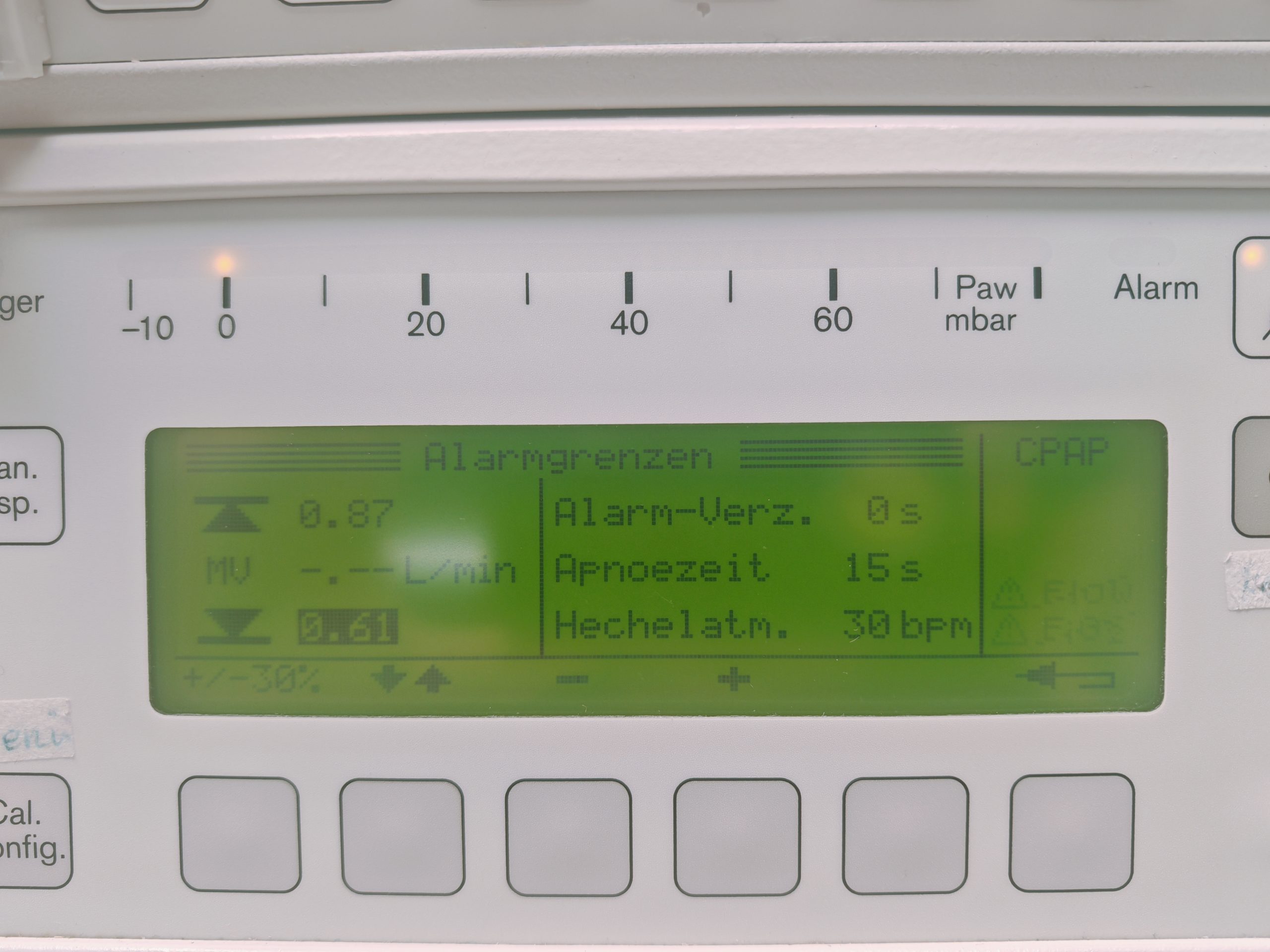 Dräger Drager Babylog 8000 + Capnostat – Beatmungsgerät thumbnail 4