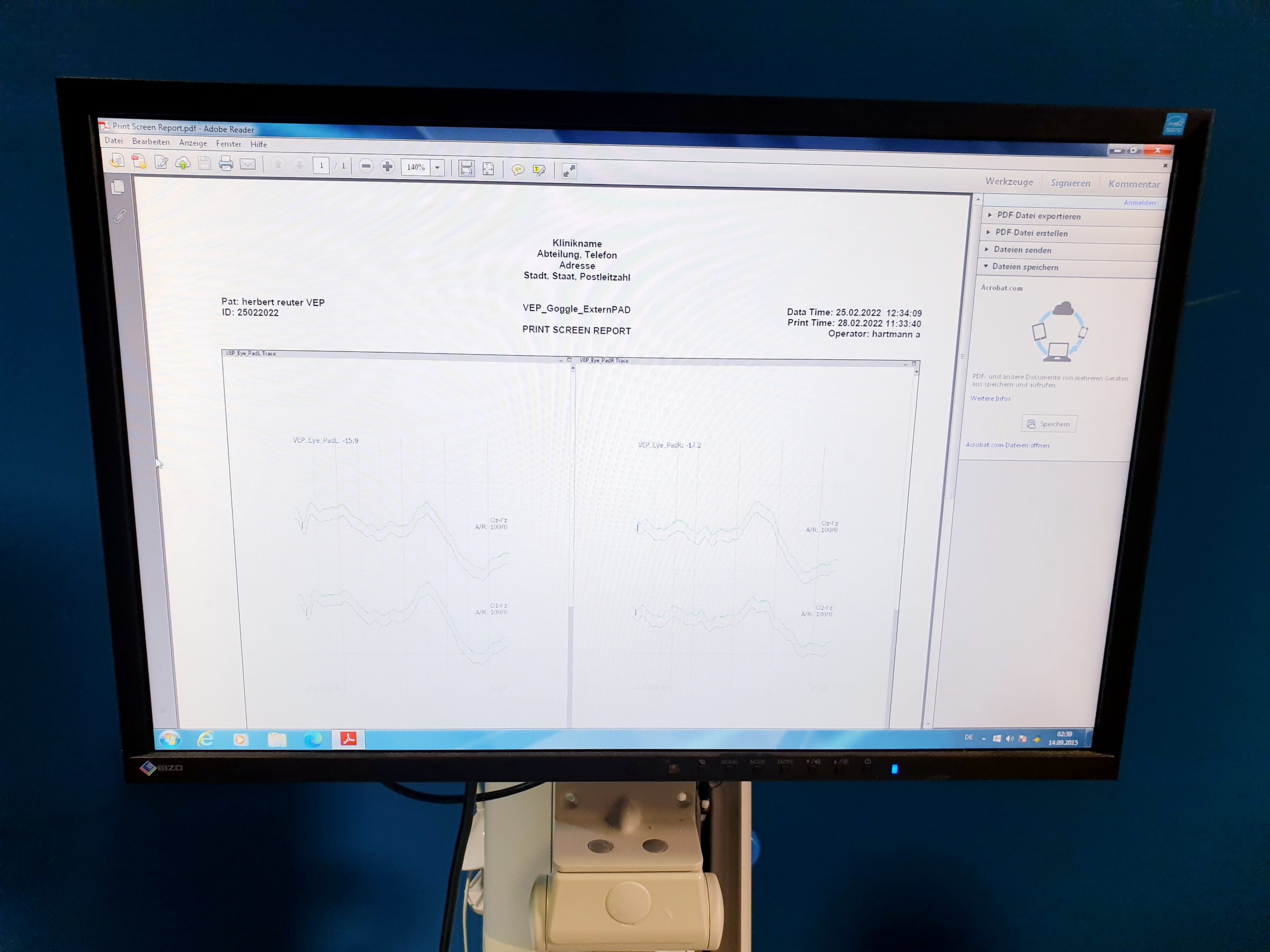 Medtronic NIM Eclipse E4 Nerven Monitoring System thumbnail 18