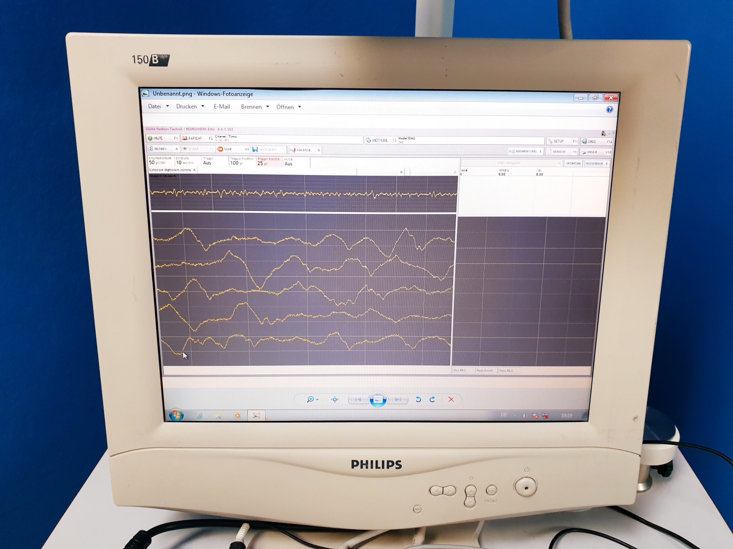Sigma Neurowerk EMG4 – SW V8.01.39 thumbnail 6