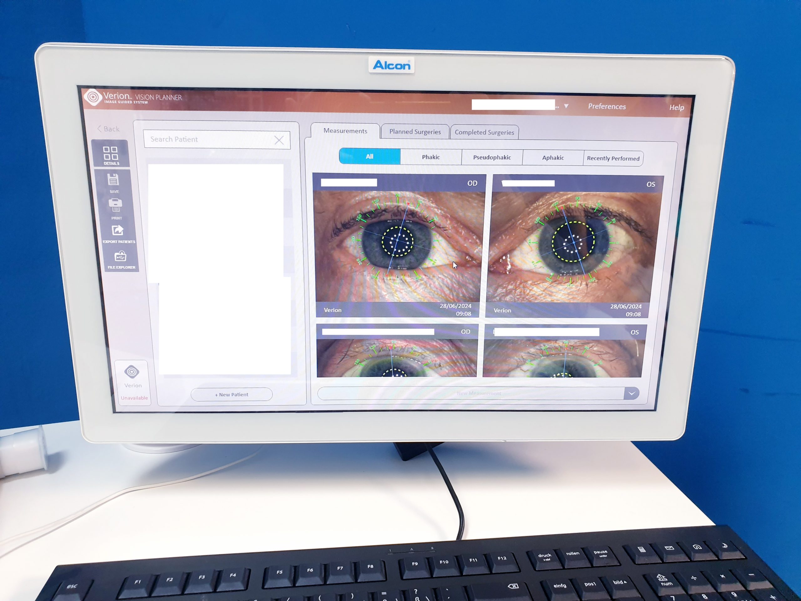 Alcon VERION Vision Planner X-RUP thumbnail 7