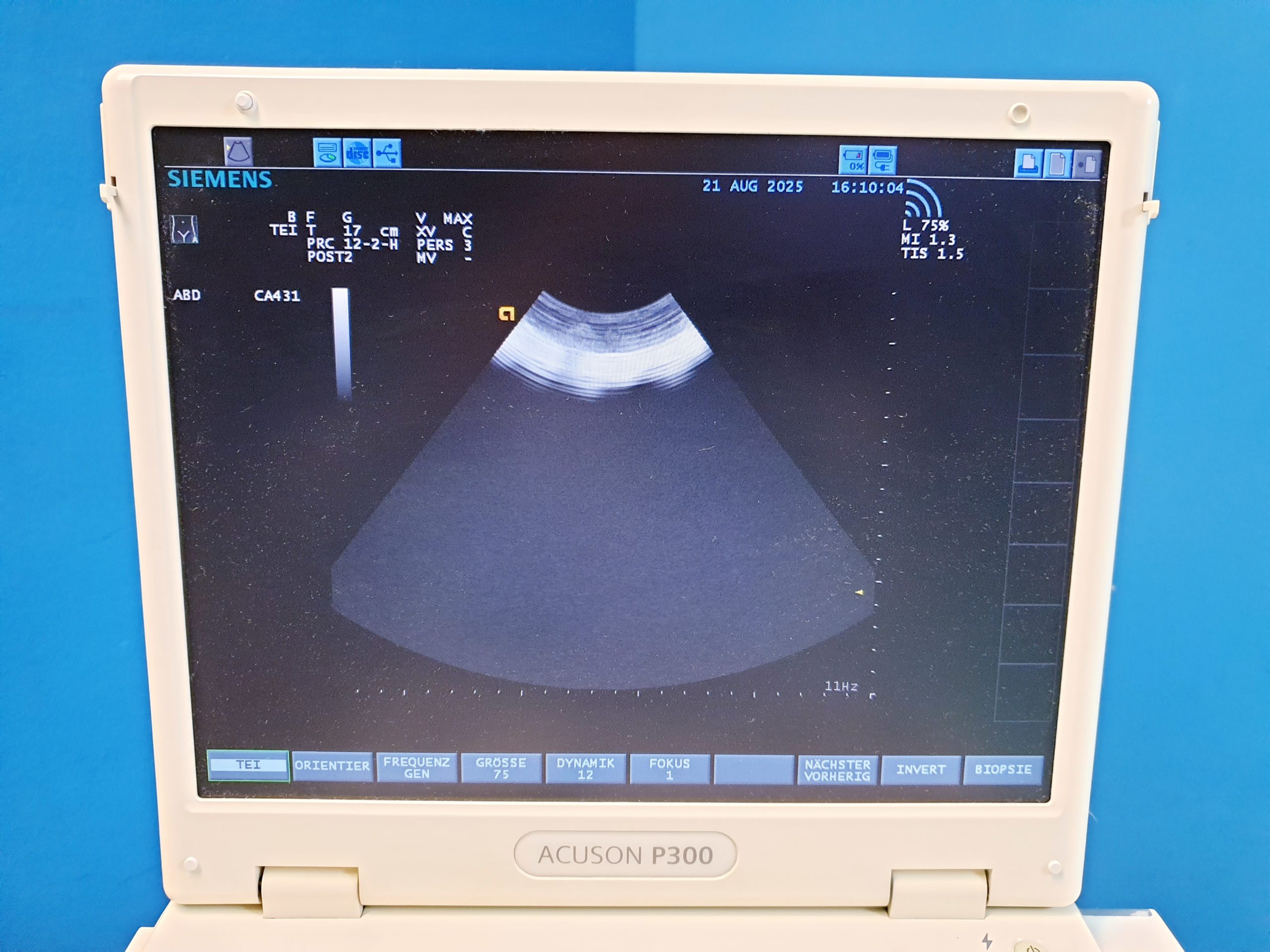 Siemens CA431 Ultraschallsonde — image 1 of 8