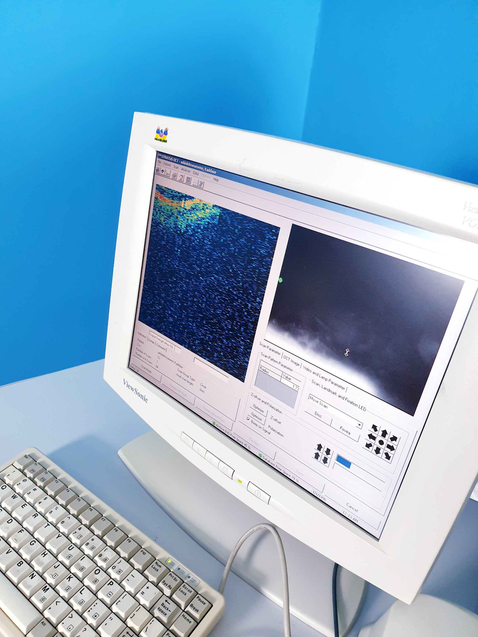 Zeiss Stratus OCT 3000 mit Software Version 5.0.1 thumbnail 3