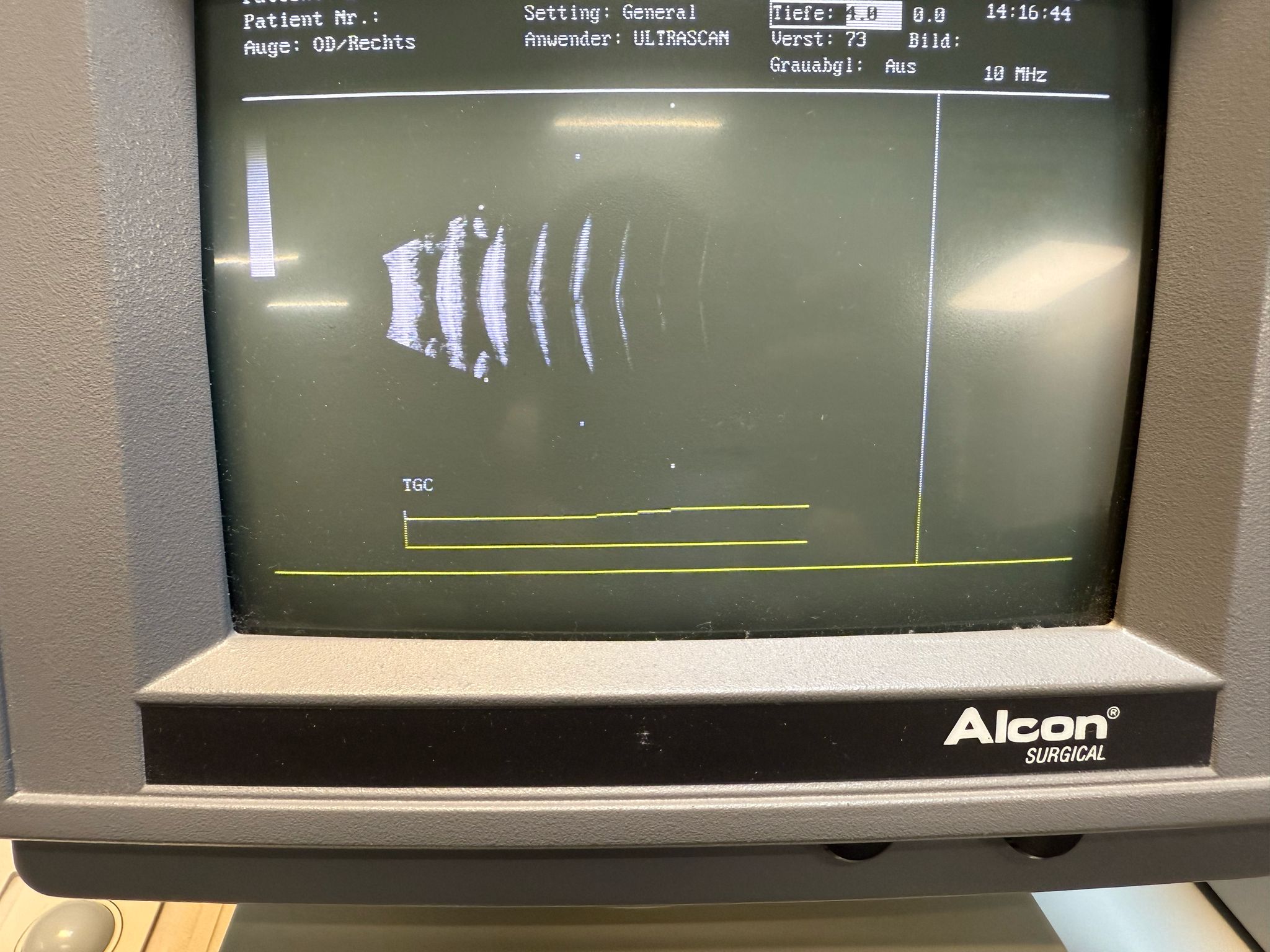 Alcon Ultrascan B-Scan und Biometer thumbnail 18