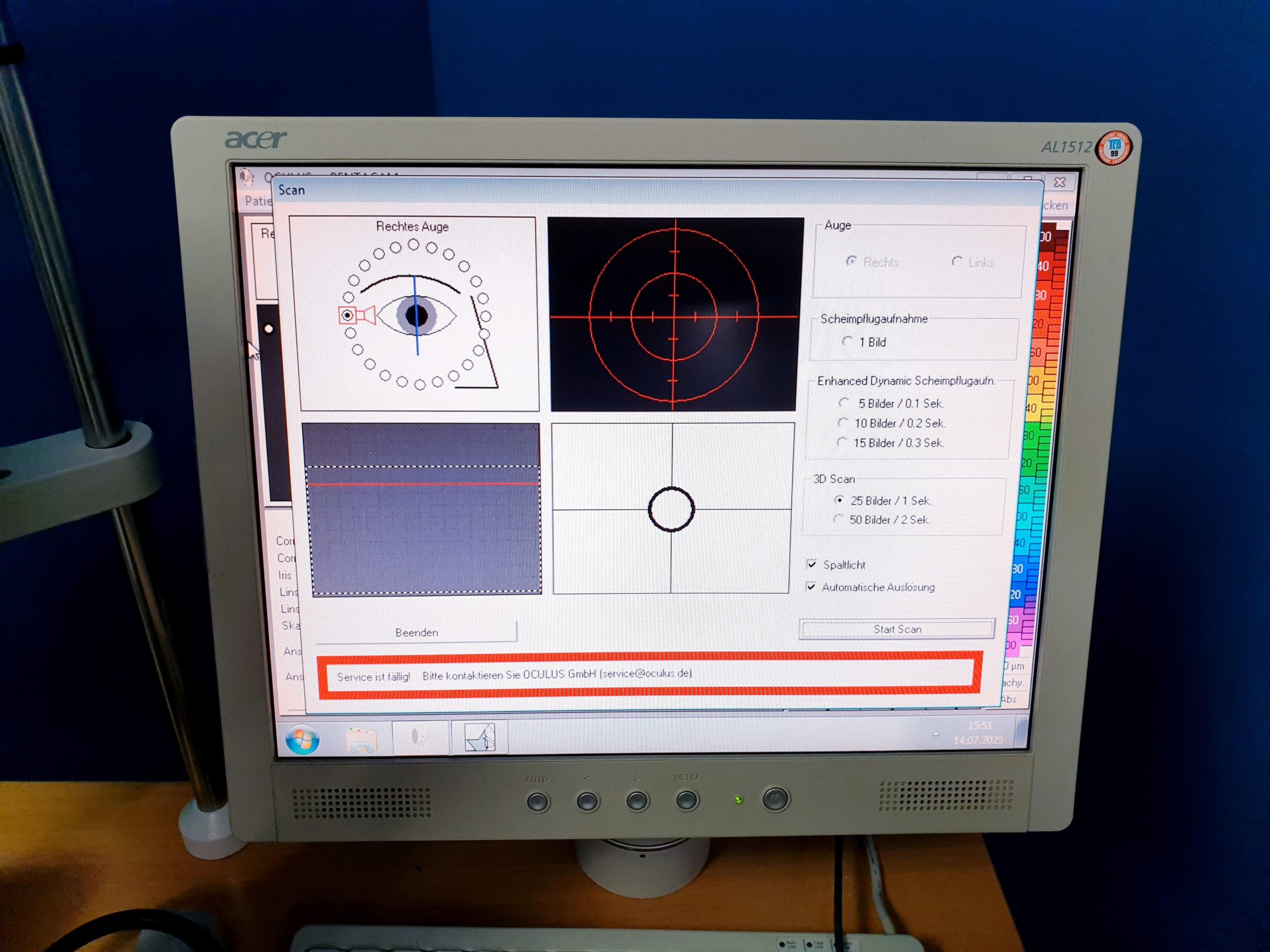 Oculus Pentacam 70700 Anterior Eye Segment Tomography System thumbnail 7