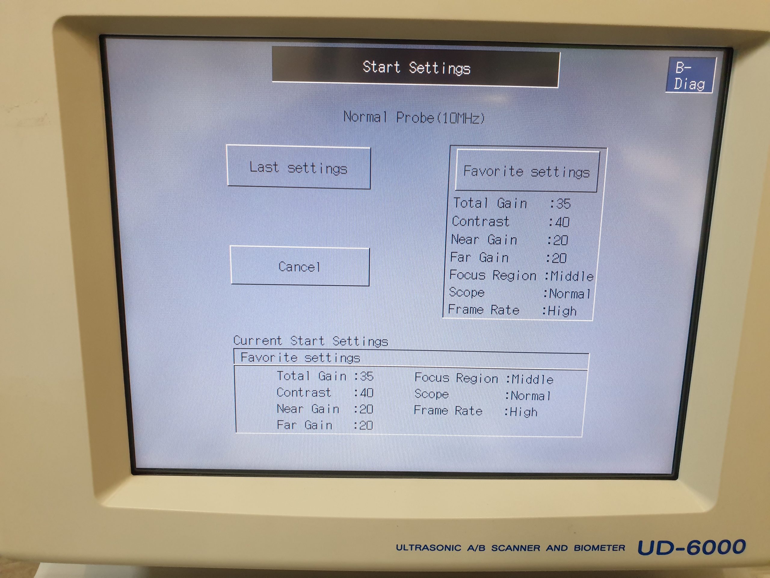 TOMEY UD-6000 Ultrasound Ultrasonic AB Scanner and Biometer thumbnail 2