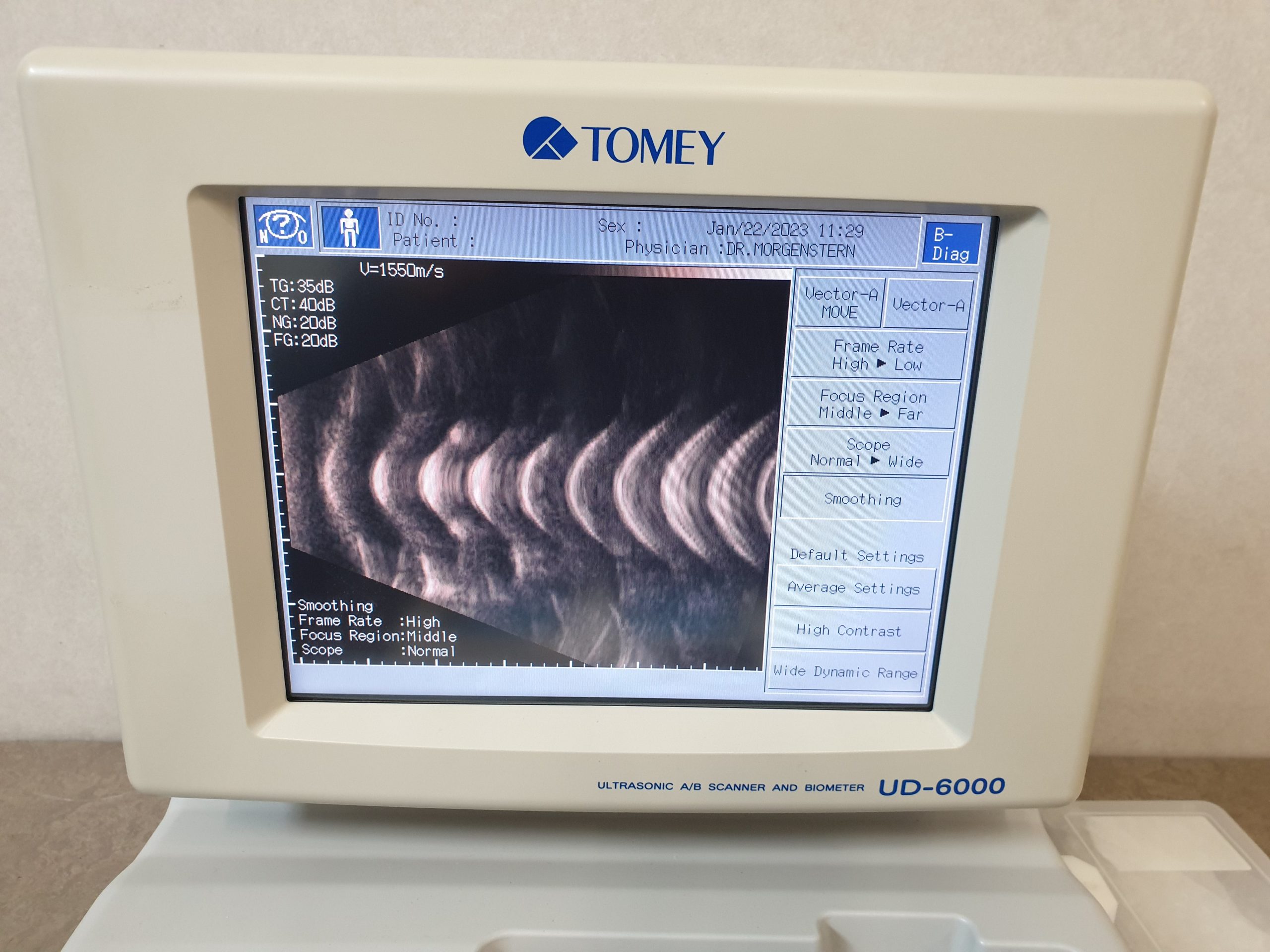 TOMEY UD-6000 Ultrasound Ultrasonic AB Scanner and Biometer thumbnail 4