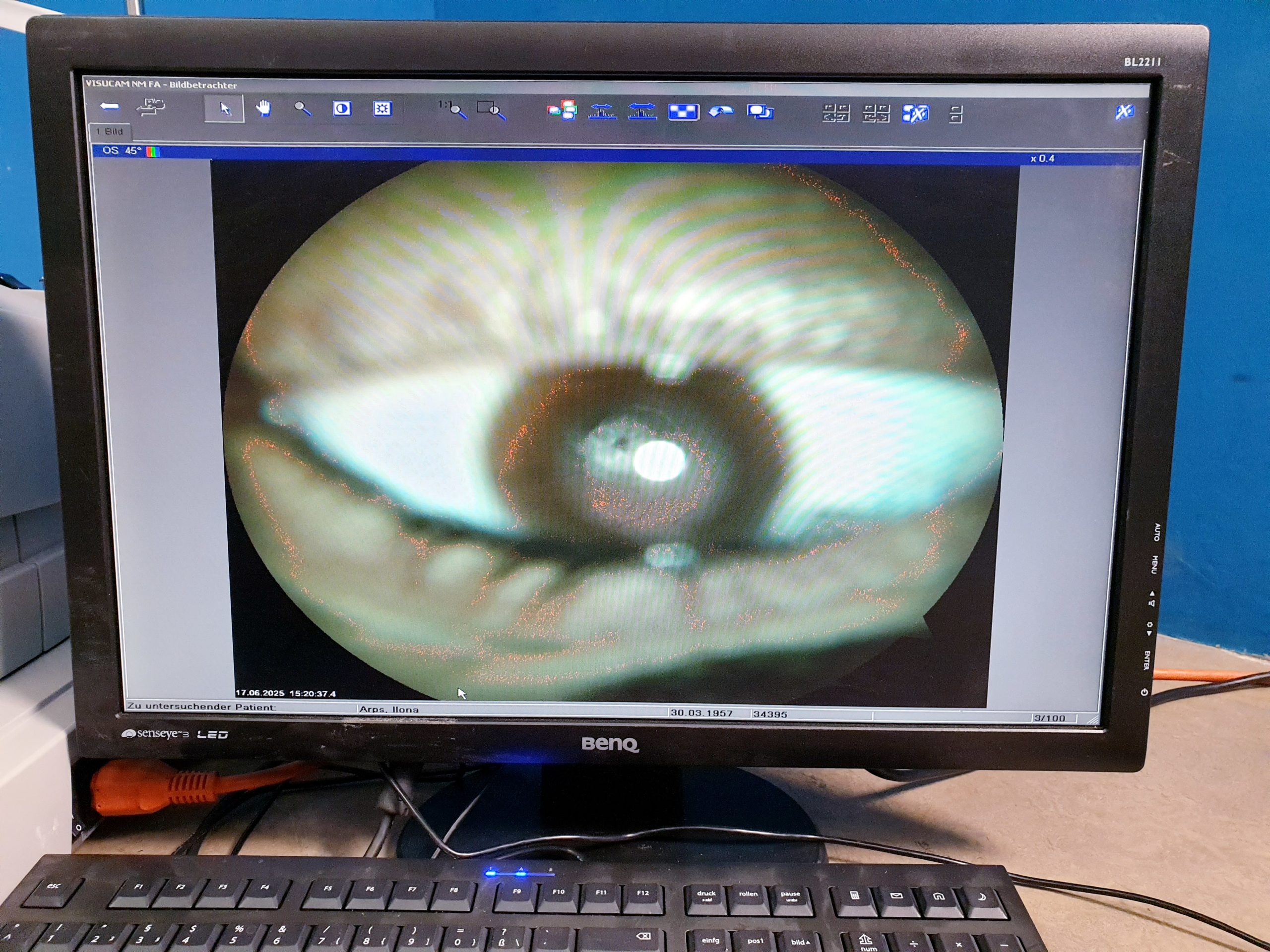 Carl zeiss Visucam NM FM Funduskamera thumbnail 4