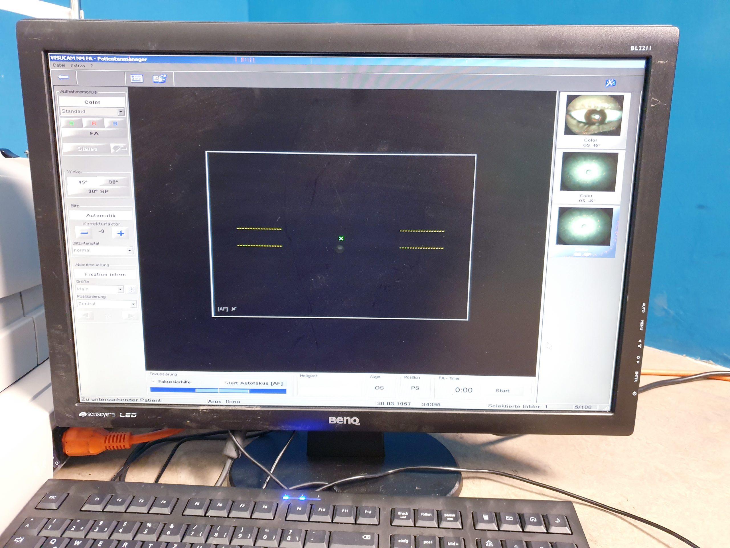 Carl zeiss Visucam NM FM Funduskamera thumbnail 5