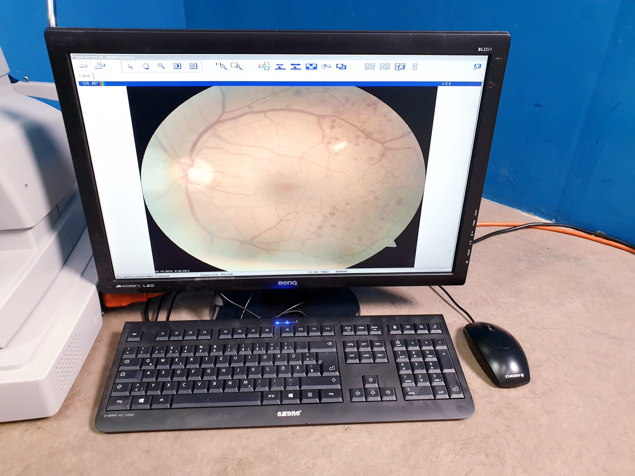 Carl zeiss Visucam NM FM Funduskamera thumbnail 7