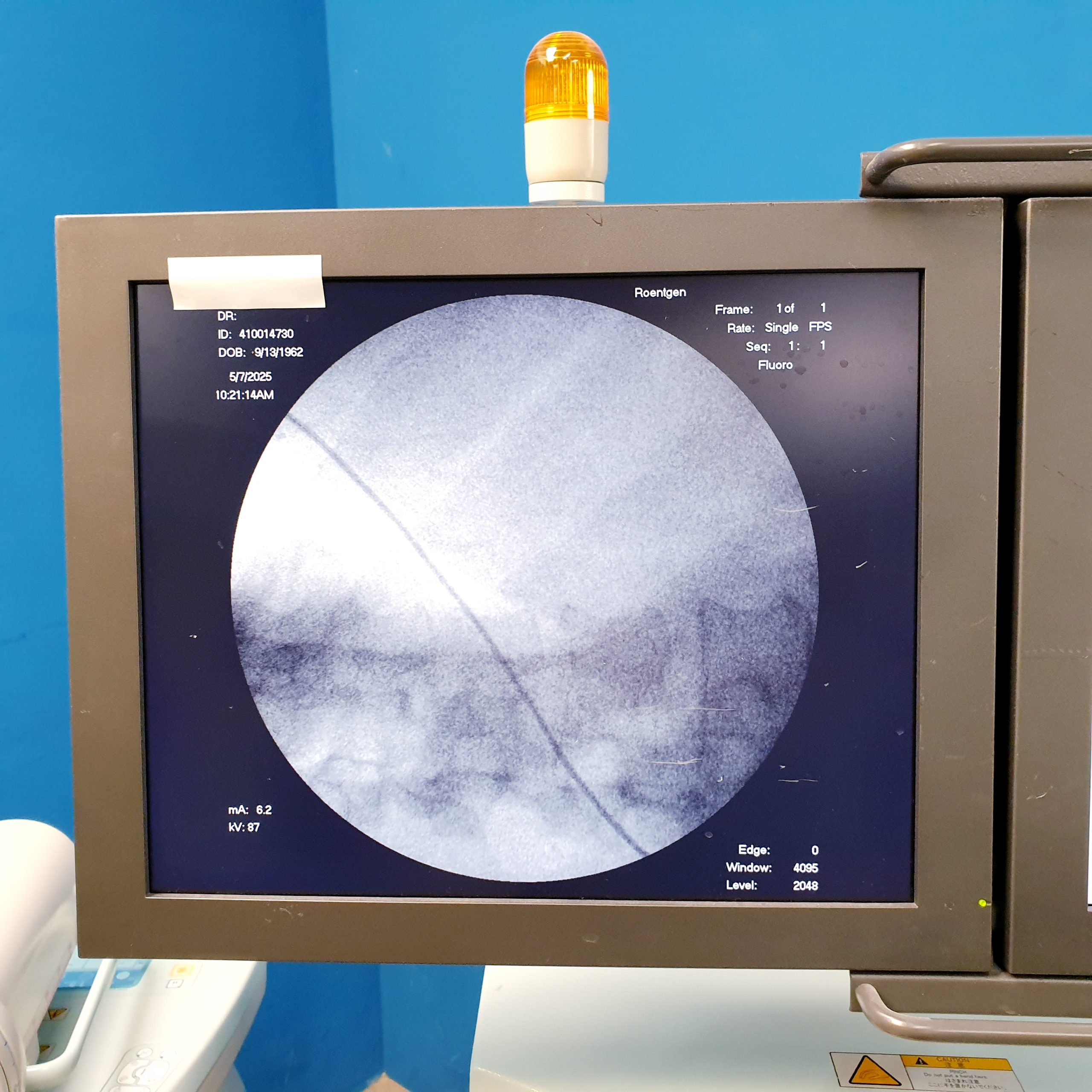 Shimadzu Opescope Pleno C-Bogen Opescope Pleno C‑Arm thumbnail 6