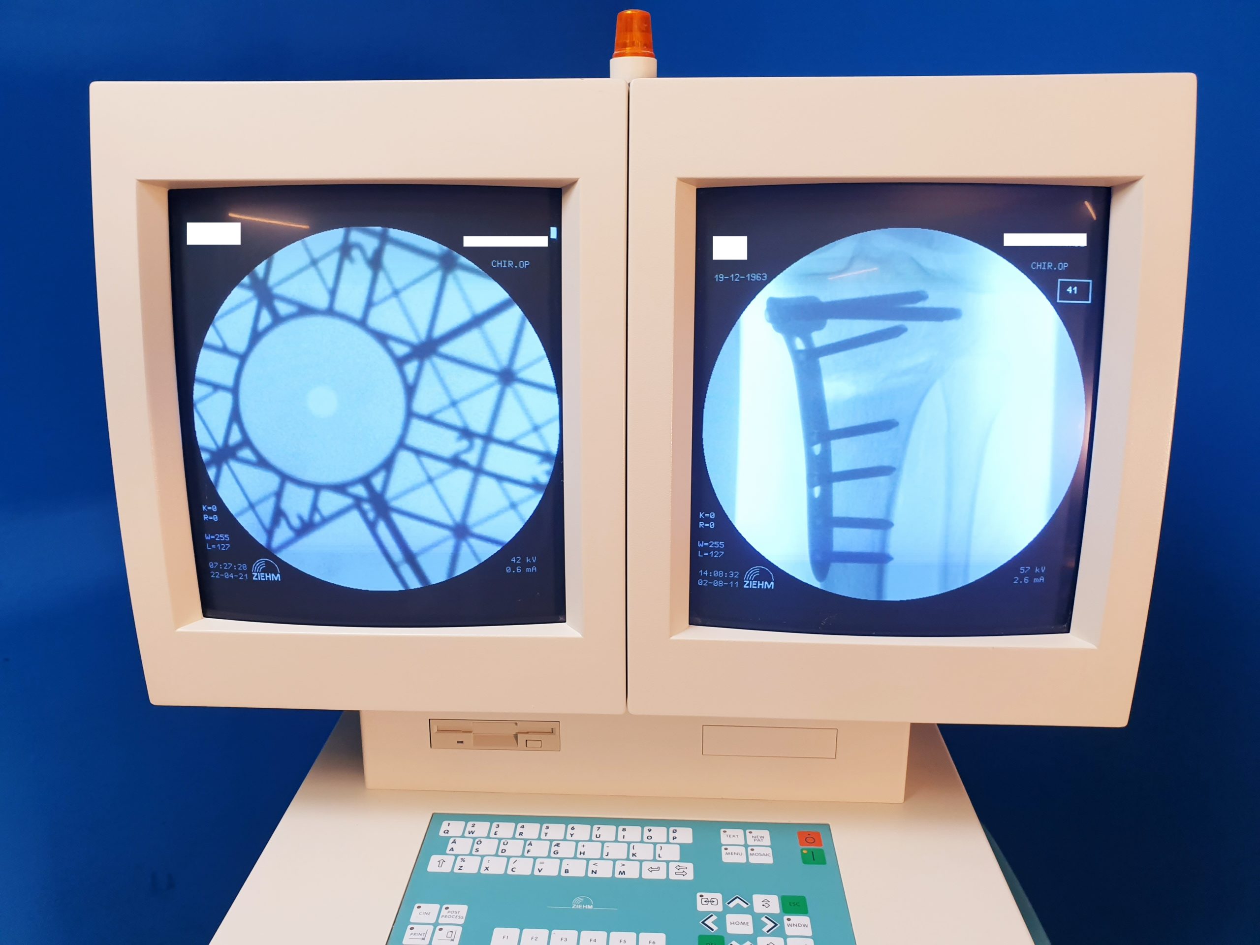 Ziehm Exposcop 8000 C Bogen Mobiles Röntgengerät mit doppeltem Monitor thumbnail 2