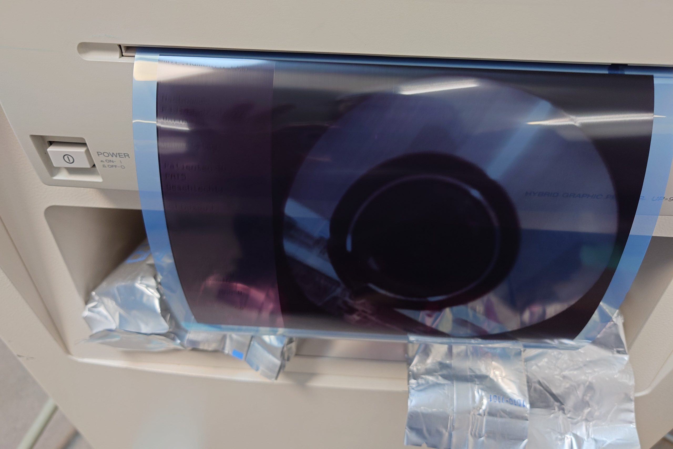 ZIEHM Vision C Bogen Mobiles Röntgen C ARM thumbnail 5
