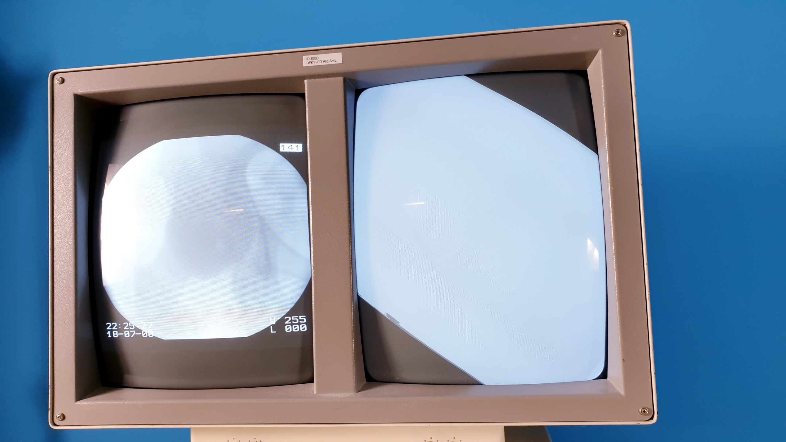 ZIEHM Exposcop CB7-D Fahrbarer C – Bogen mit Doppel-Monitor-Wagen thumbnail 7