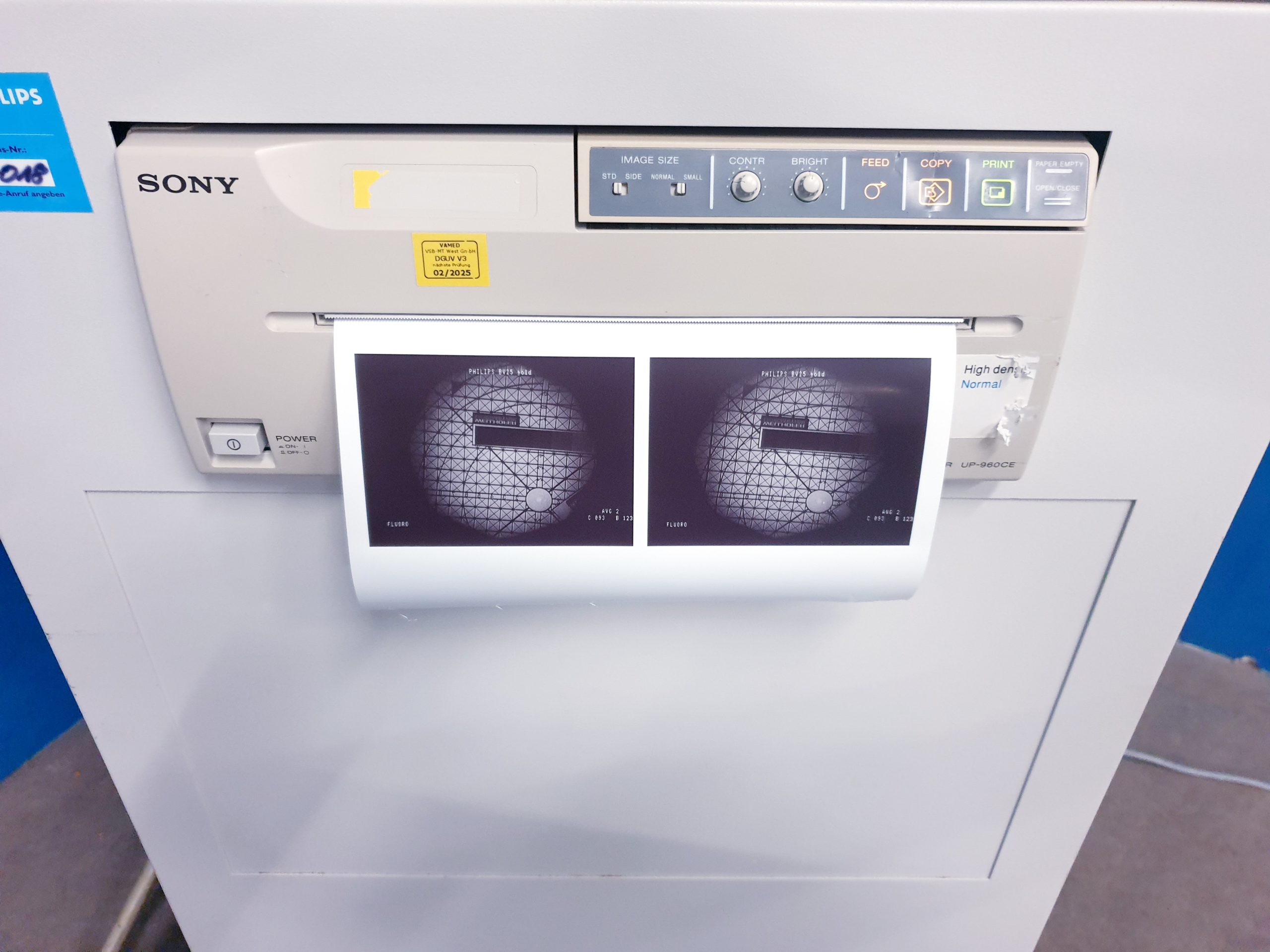 Philips BV 25 – BV25 Gold fahrbarer C-Bogen mit Doppelmonitor thumbnail 17