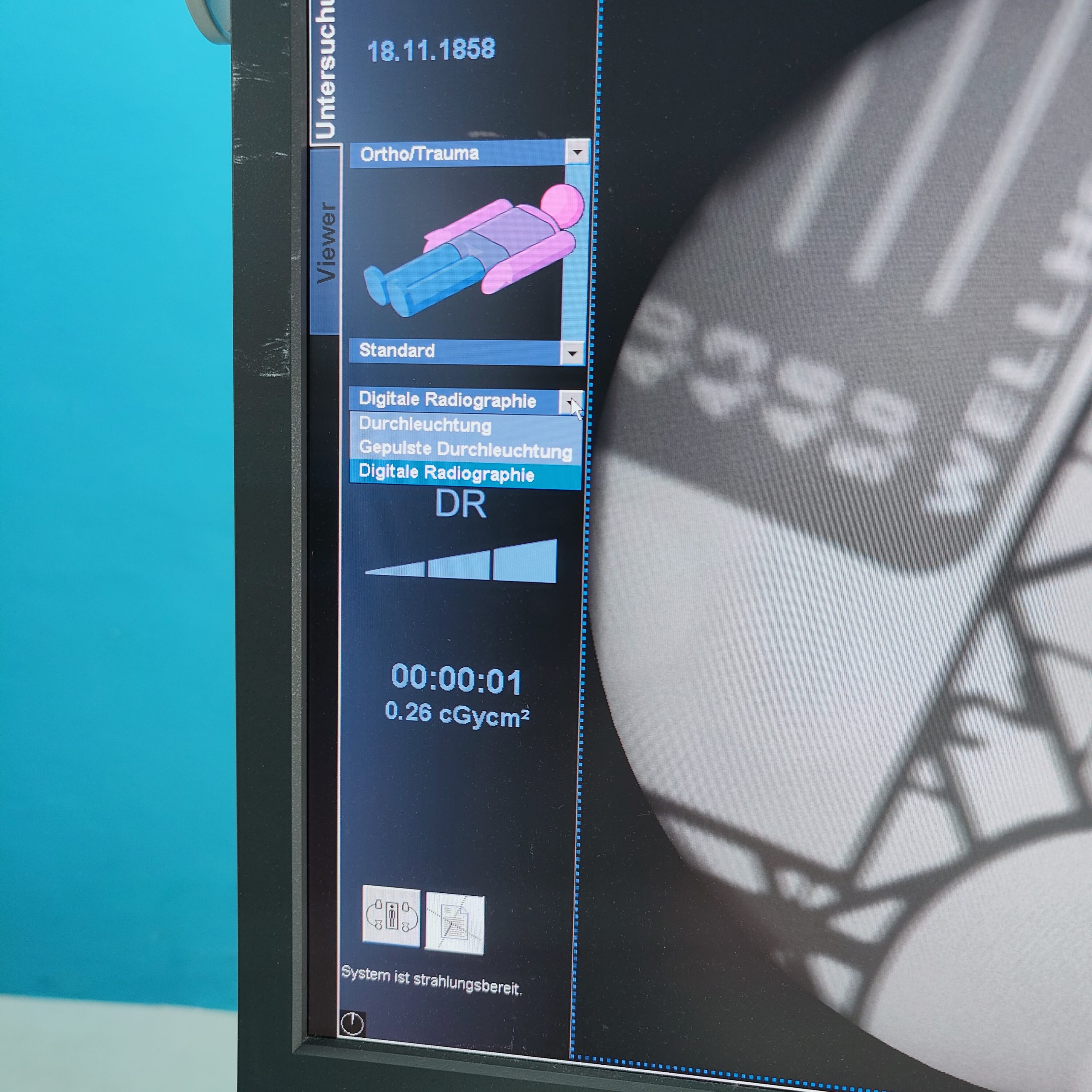 SIEMENS ARCADIS Orbic 3D C-Bogen thumbnail 2