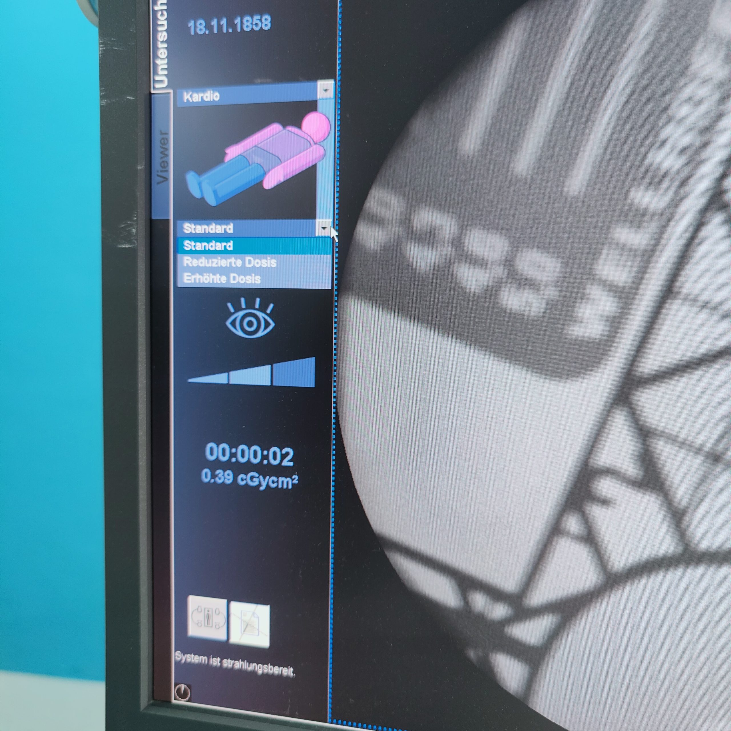 SIEMENS ARCADIS Orbic 3D C-Bogen thumbnail 3