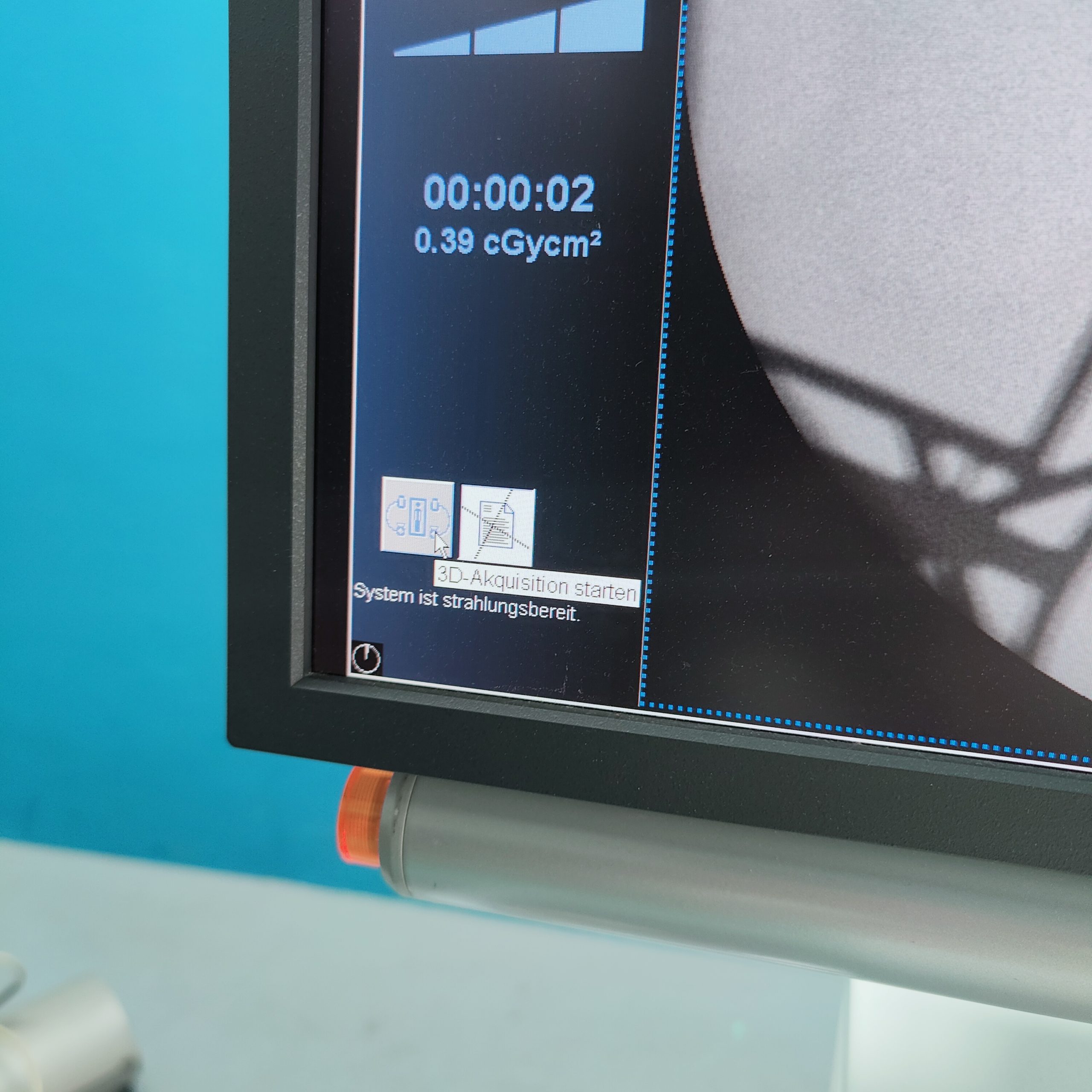 SIEMENS ARCADIS Orbic 3D C-Bogen thumbnail 6